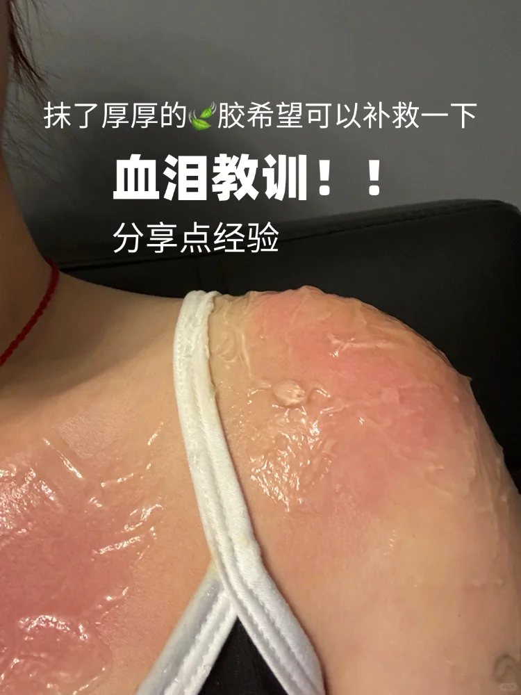 血泪教训｜5月在新疆能晒成这样我也是服了