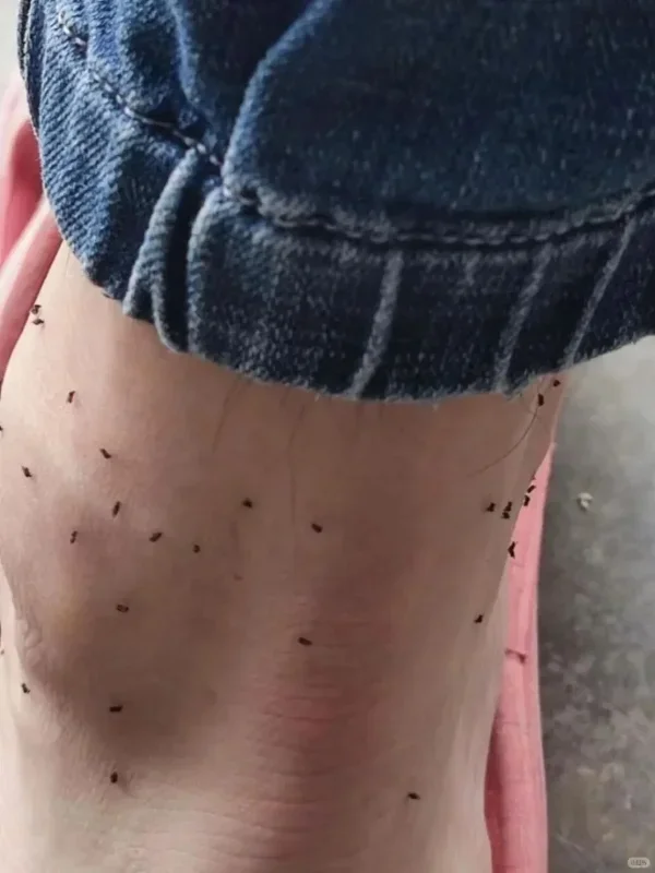 给七八月份去厦门旅游人的血泪提醒