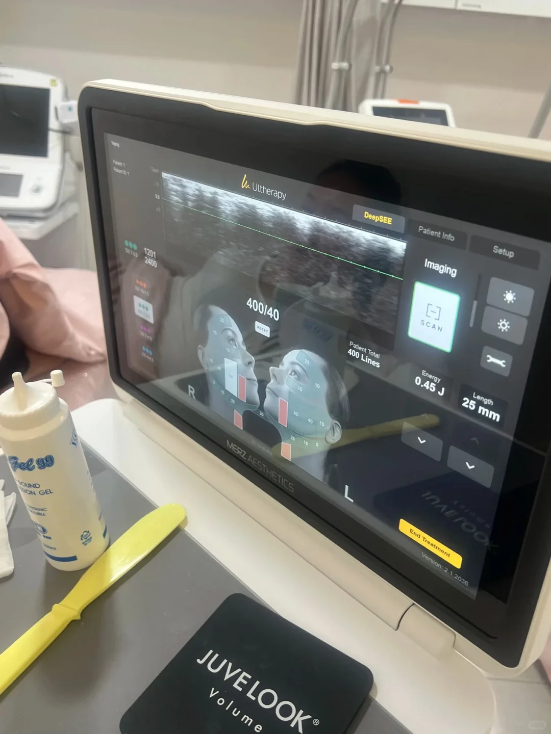 小红书搜不到的pfk 韩国本地人强烈推荐