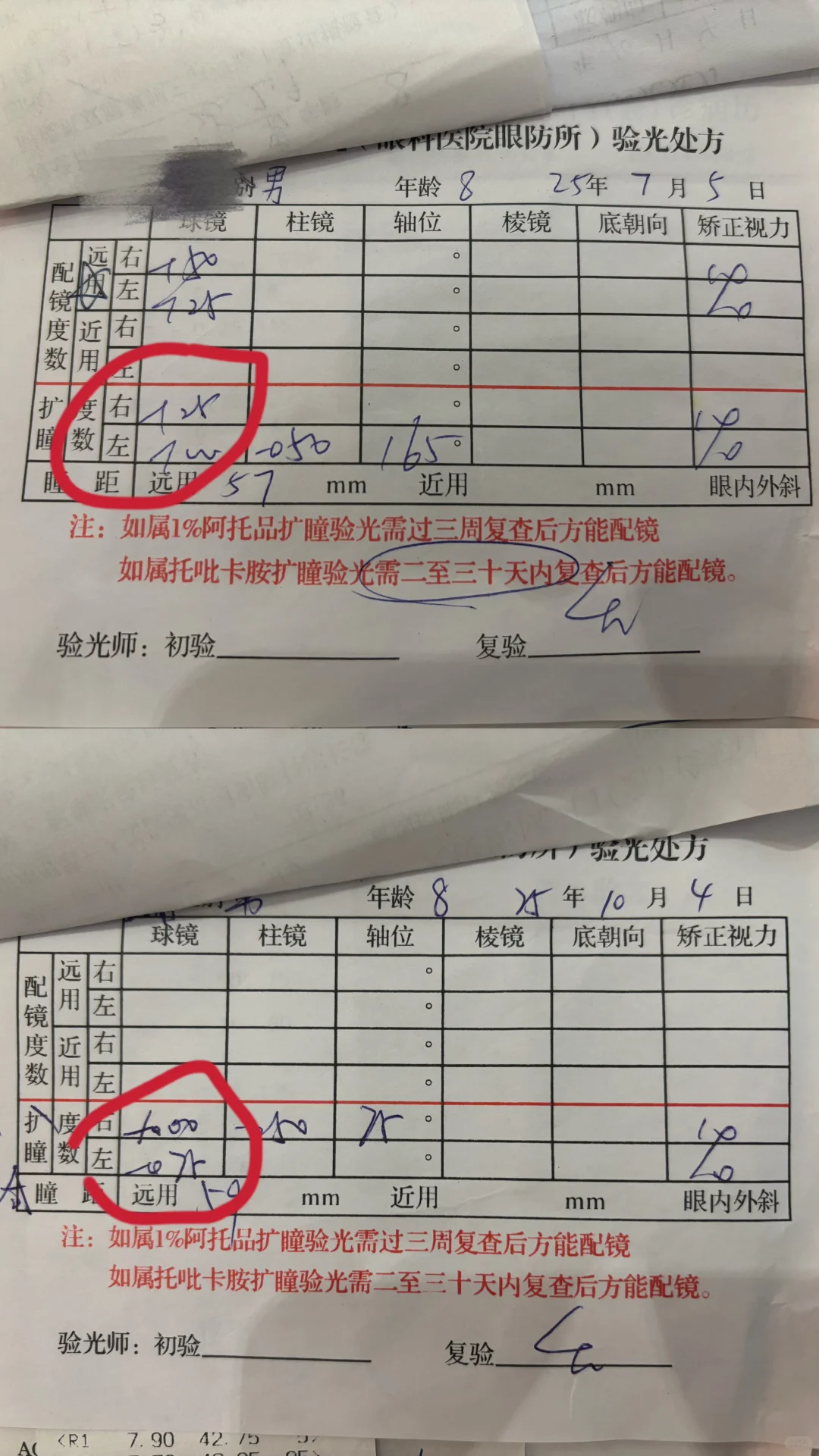 近视度数居然真的降了！眼轴也退了！