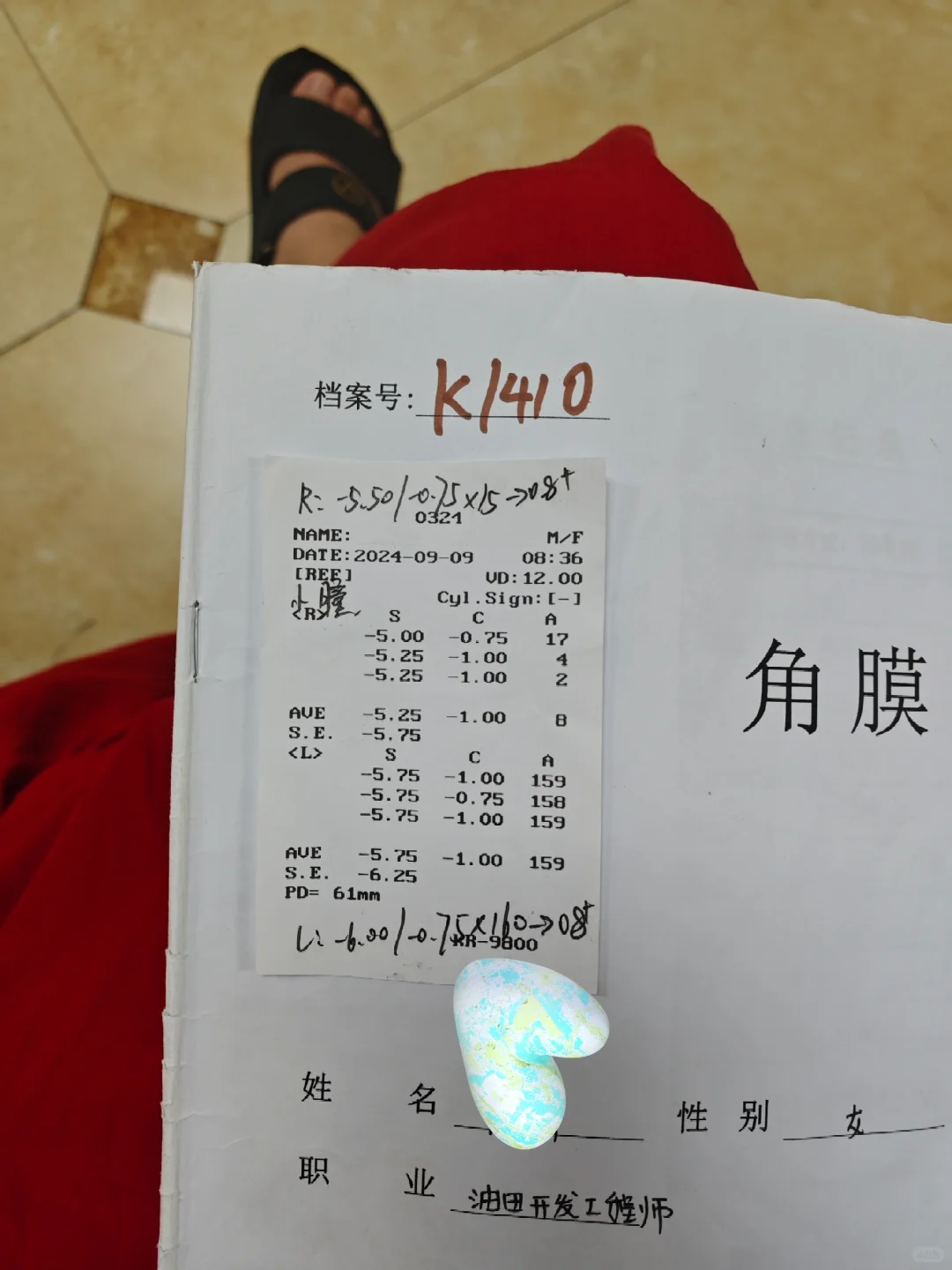 上班四年,眼睛涨了300度