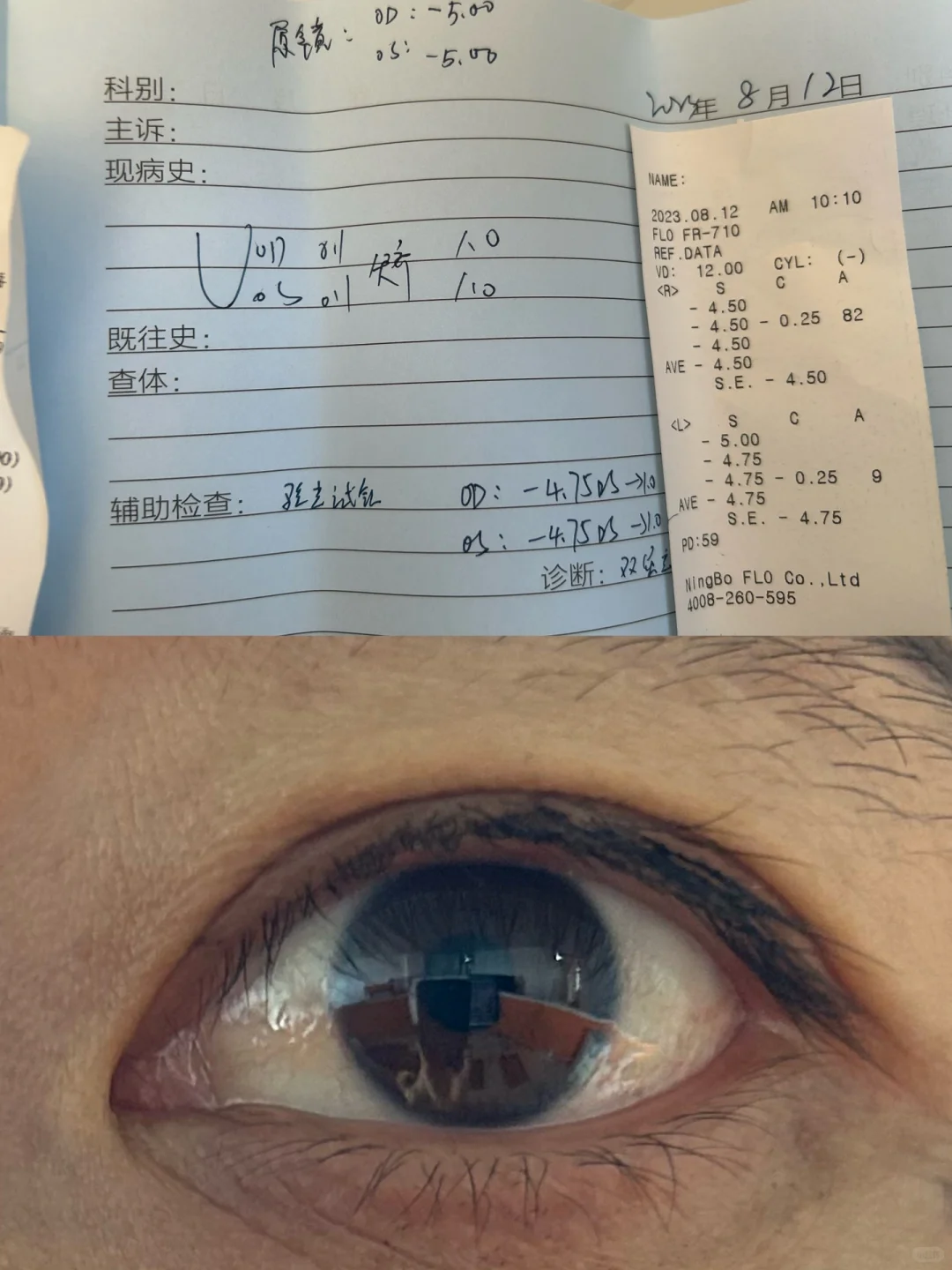 近视眼恢复【第三周】度数从500度降到了475度