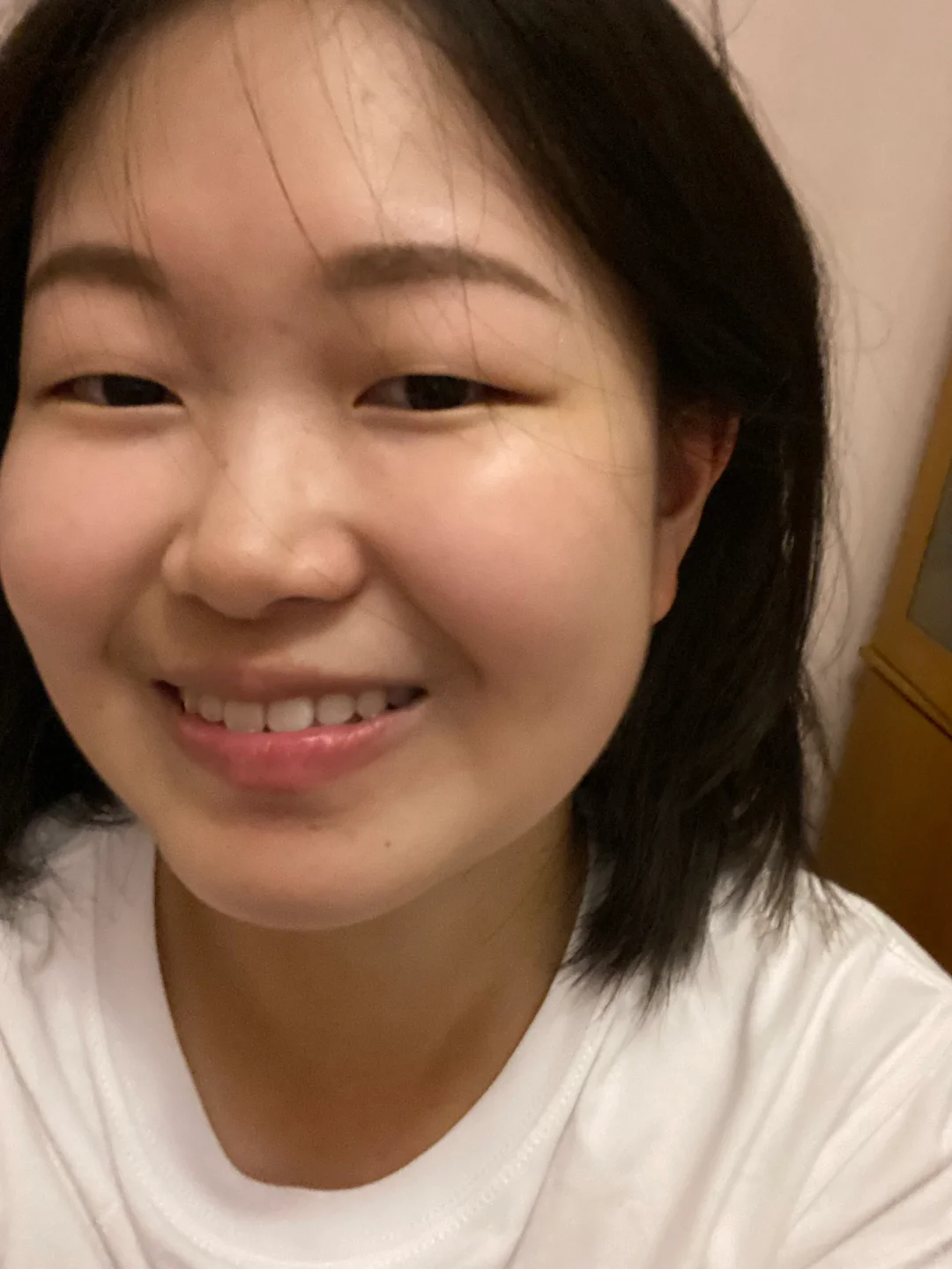 18岁高度近视600度,以后怎么办