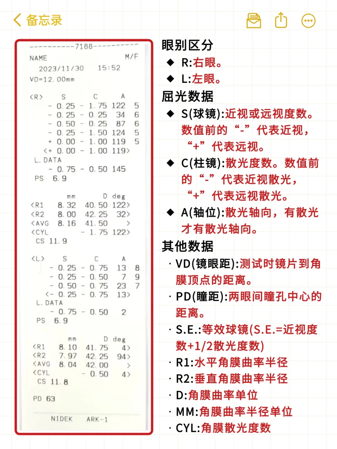?一张图教你看懂儿童验光单