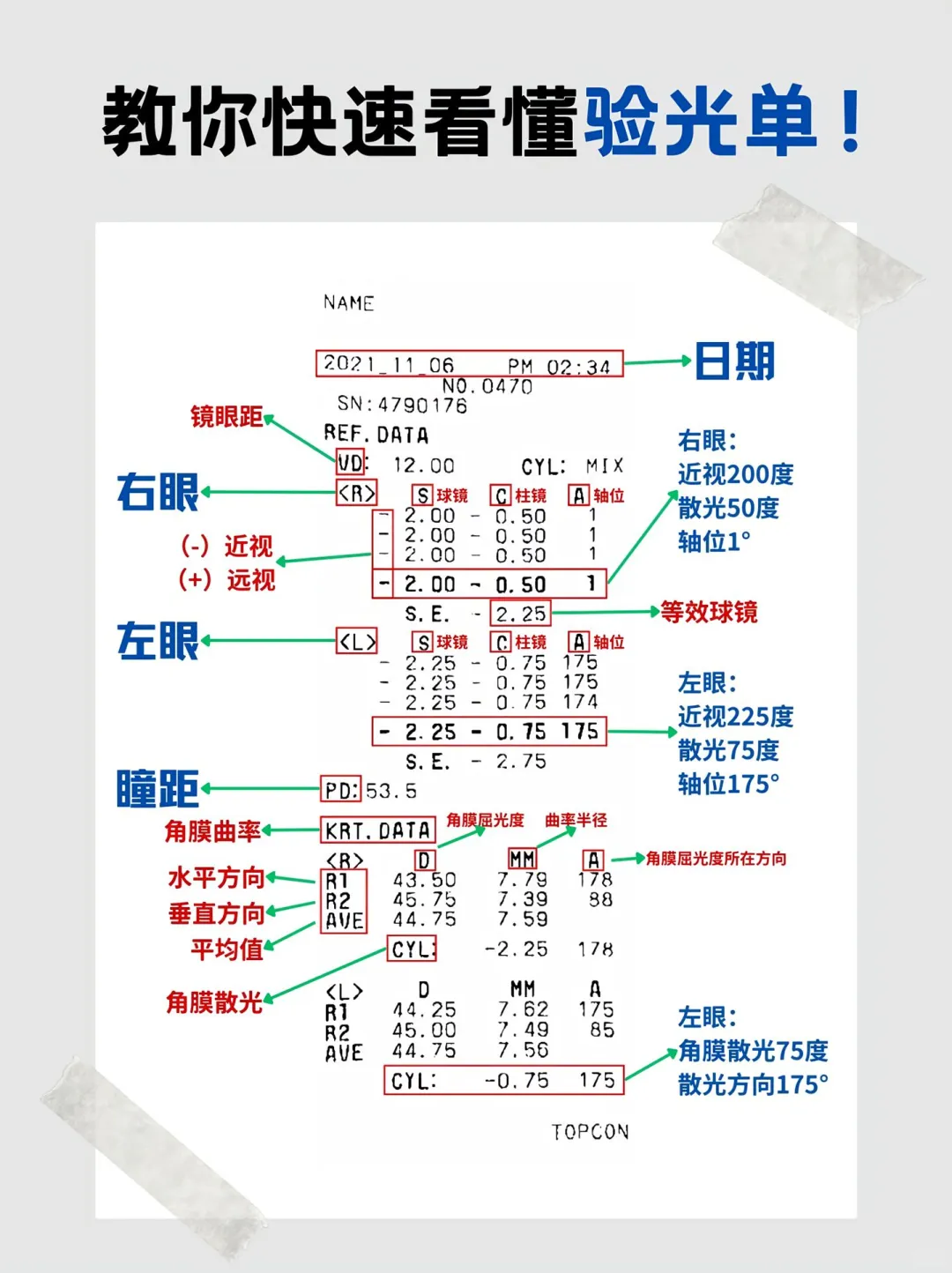 教你看验光单，小白变专家??。