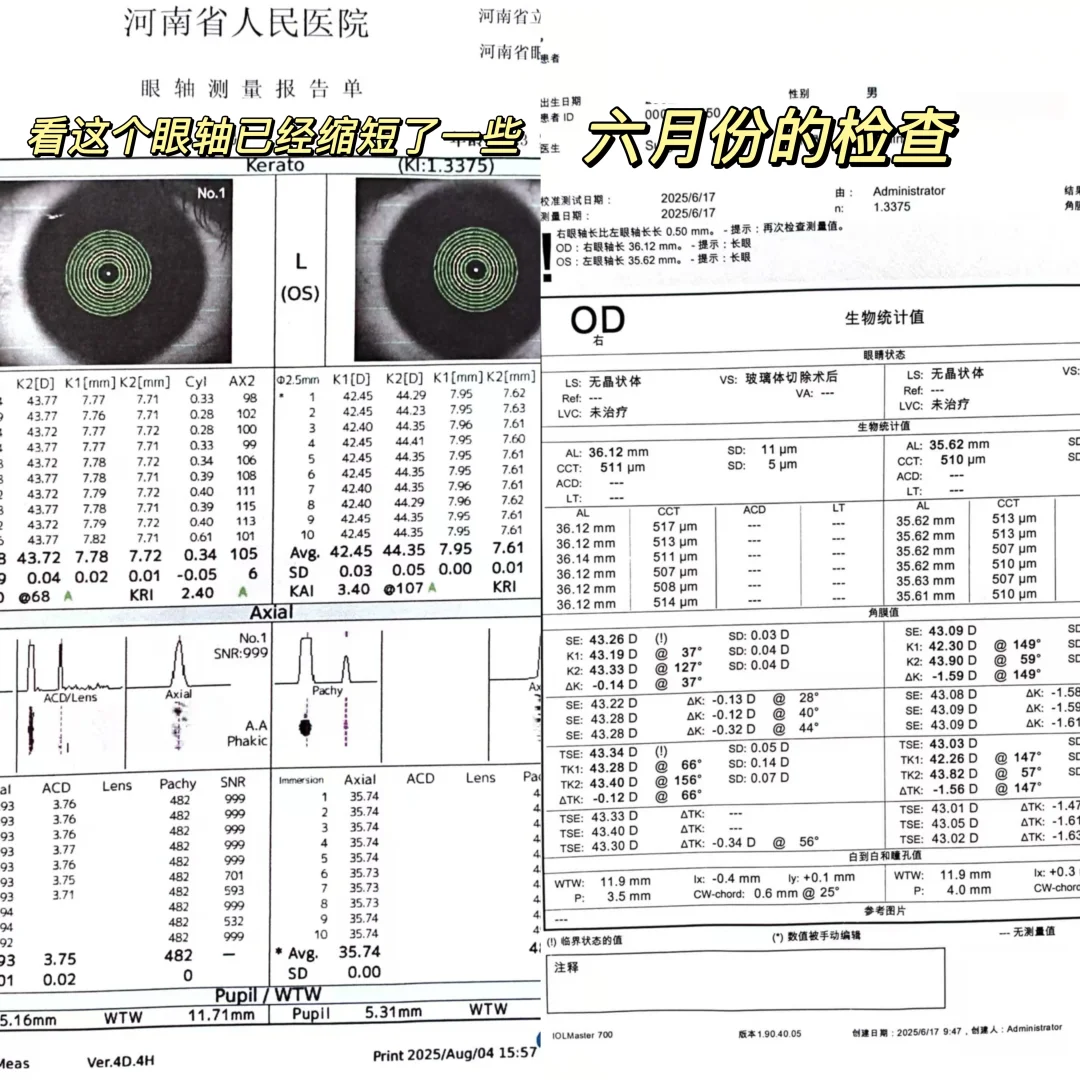 3500度到300度，为了护眼我对自己有多狠