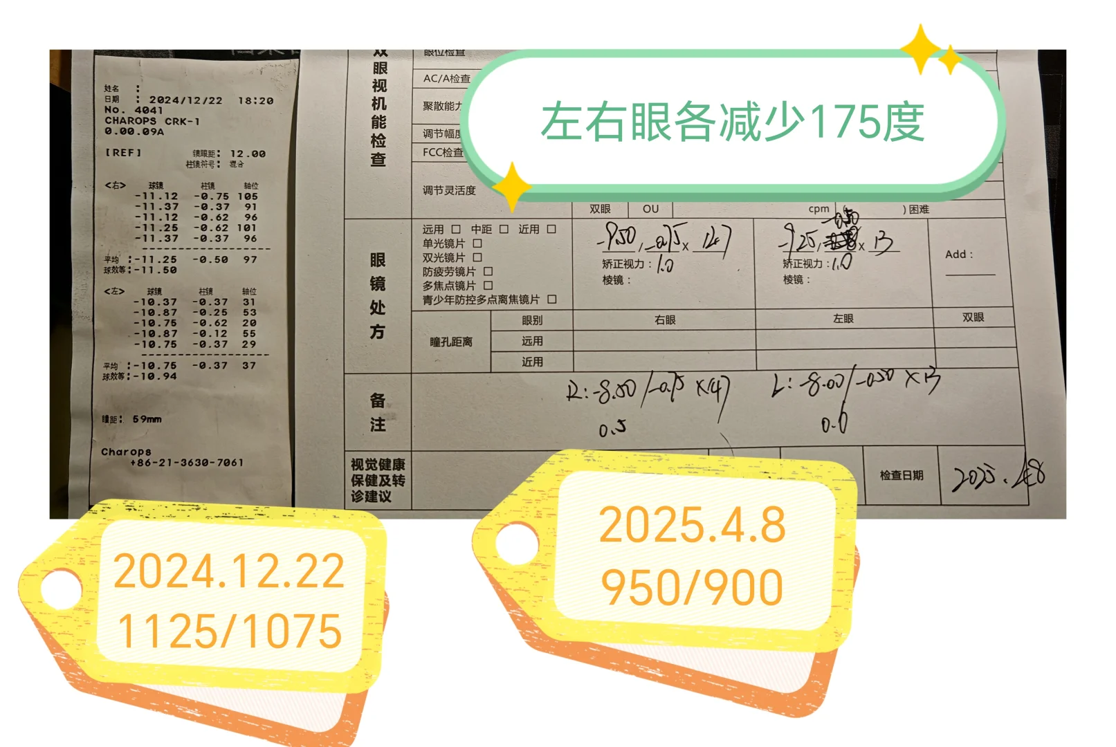 挺神奇的近视防控眼操