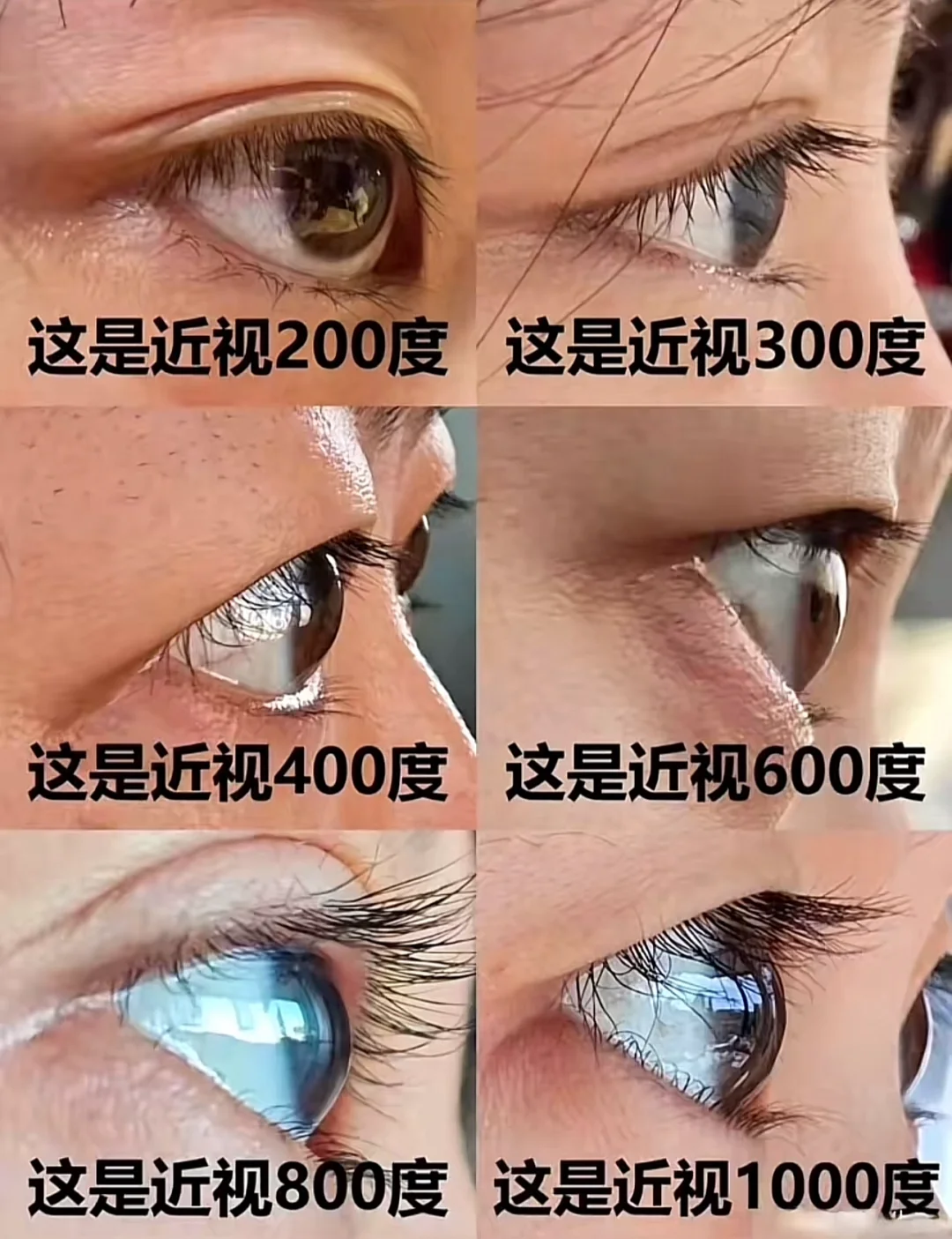 看看近视度数是正常还是过强