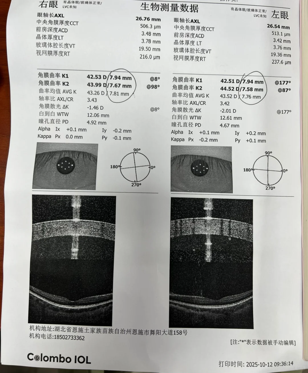 能不能帮我看看这个度数表!???