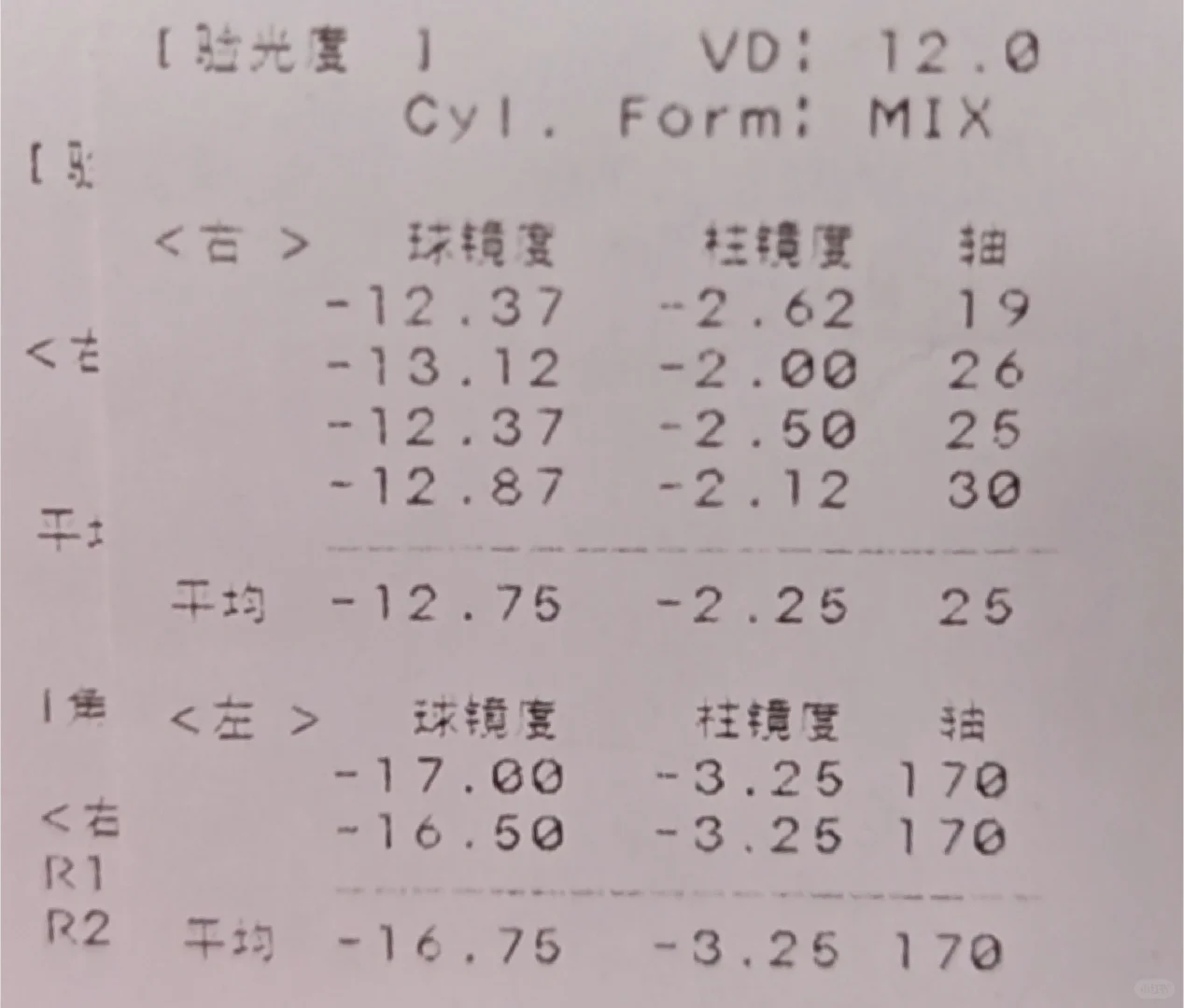 两年没测度数，一去验光天塌了