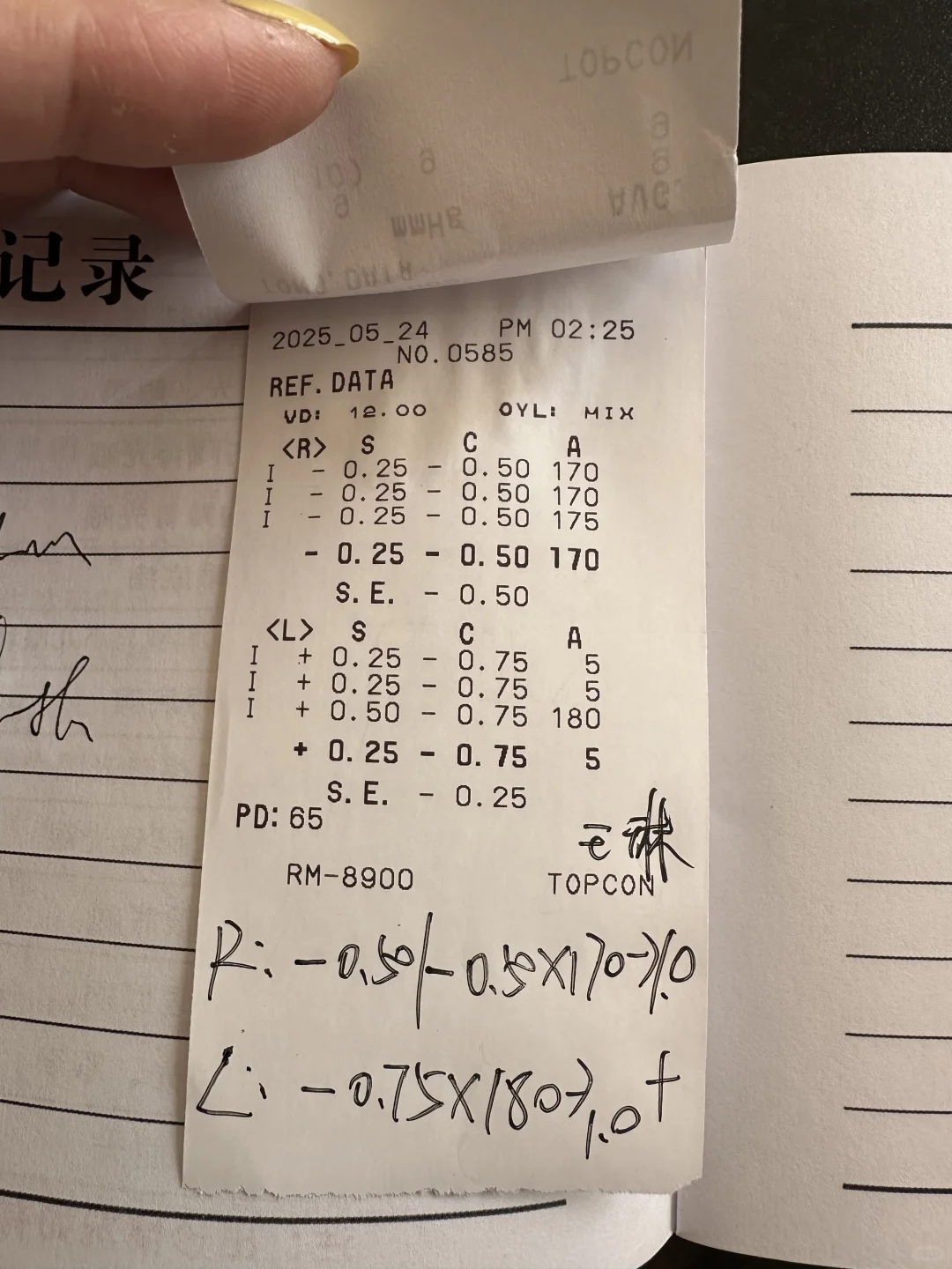 四年前的全飞秒又近视了?