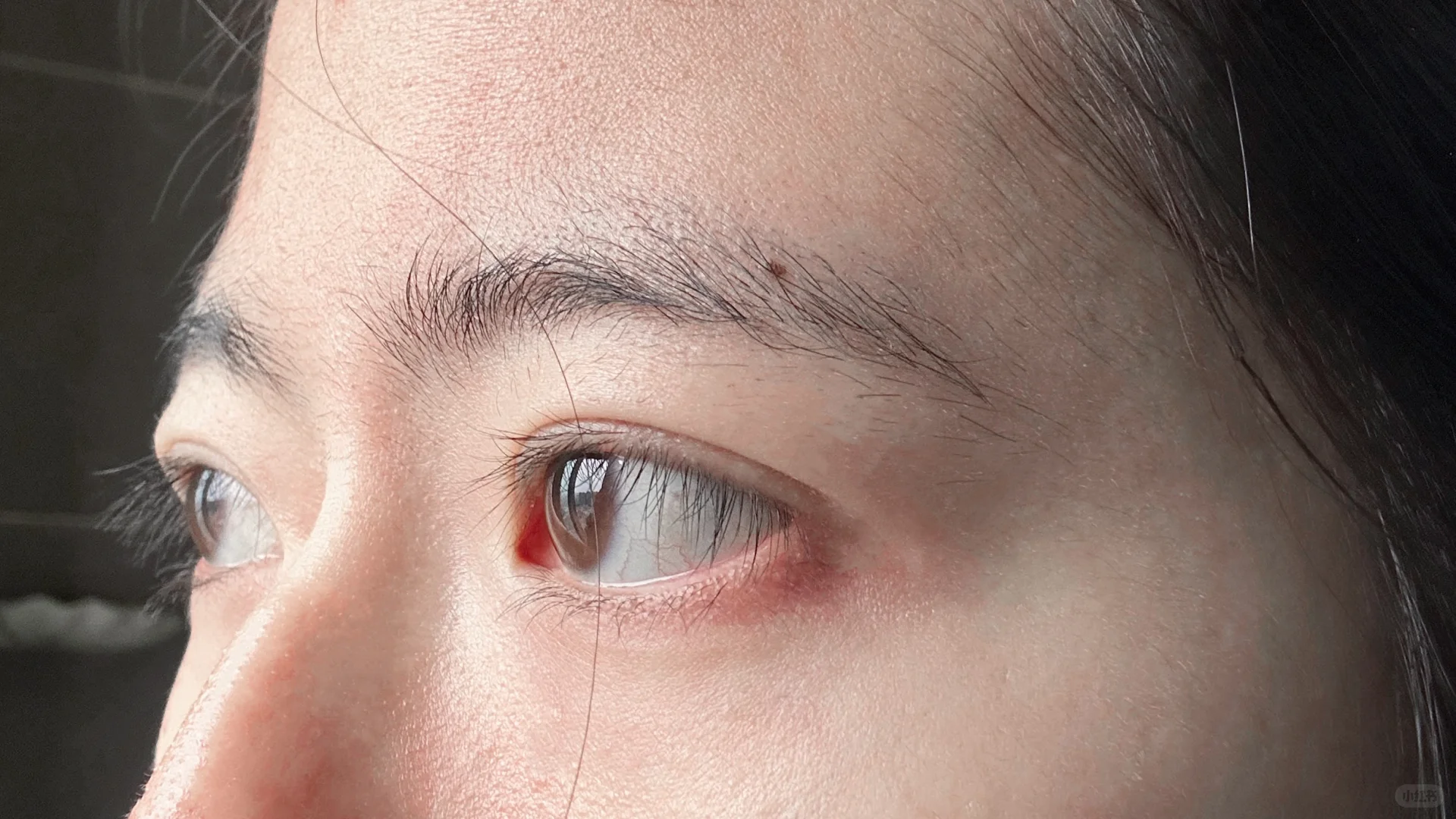 因为不想戴眼镜，所以我选择了锻炼...