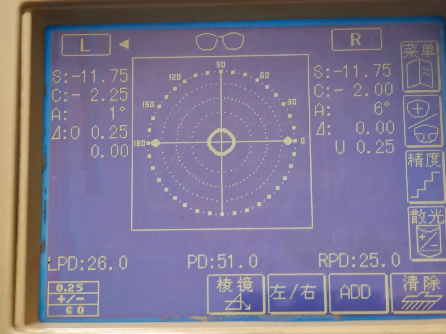 两年没测度数，一去验光天塌了
