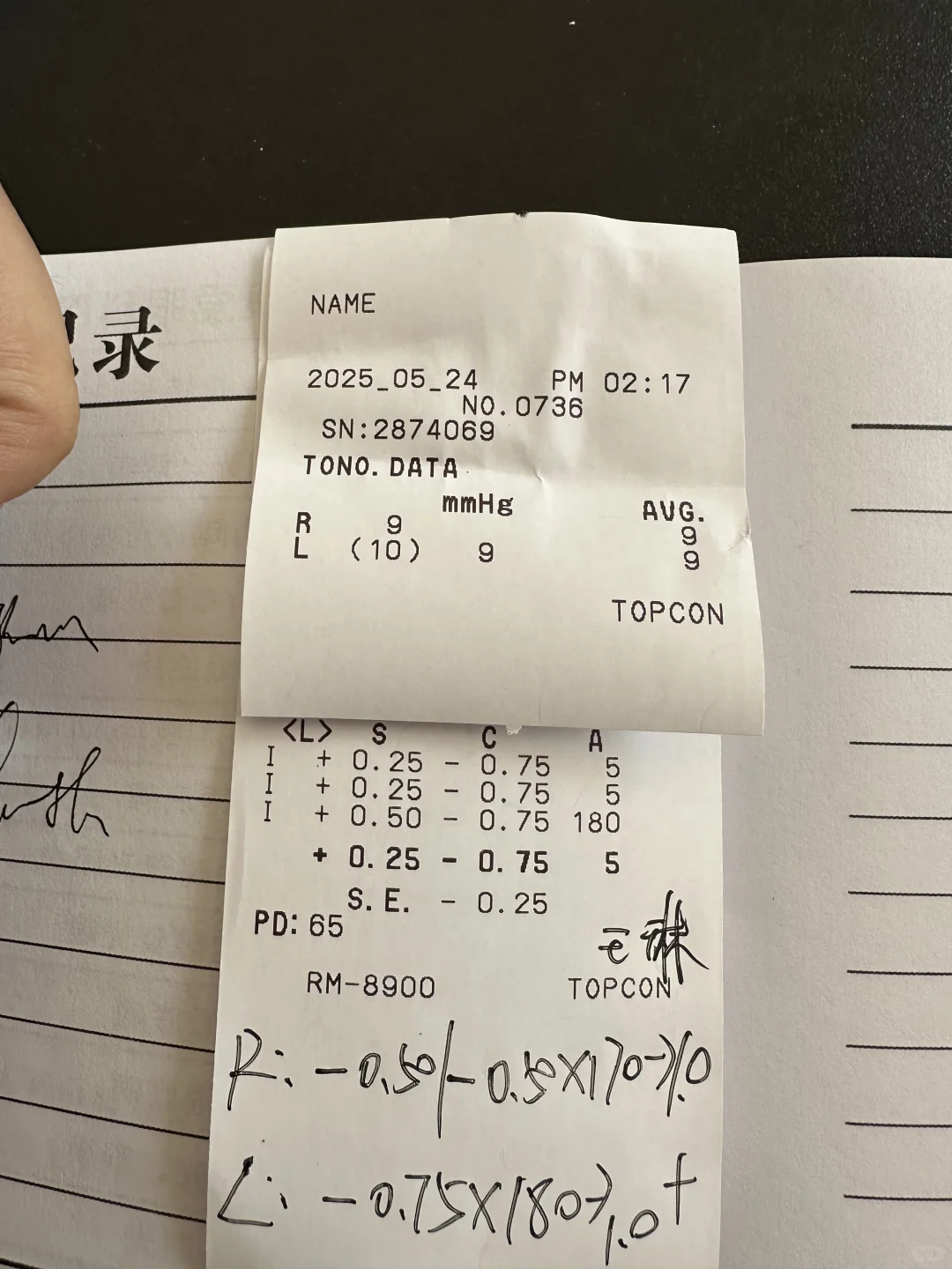 四年前的全飞秒又近视了?