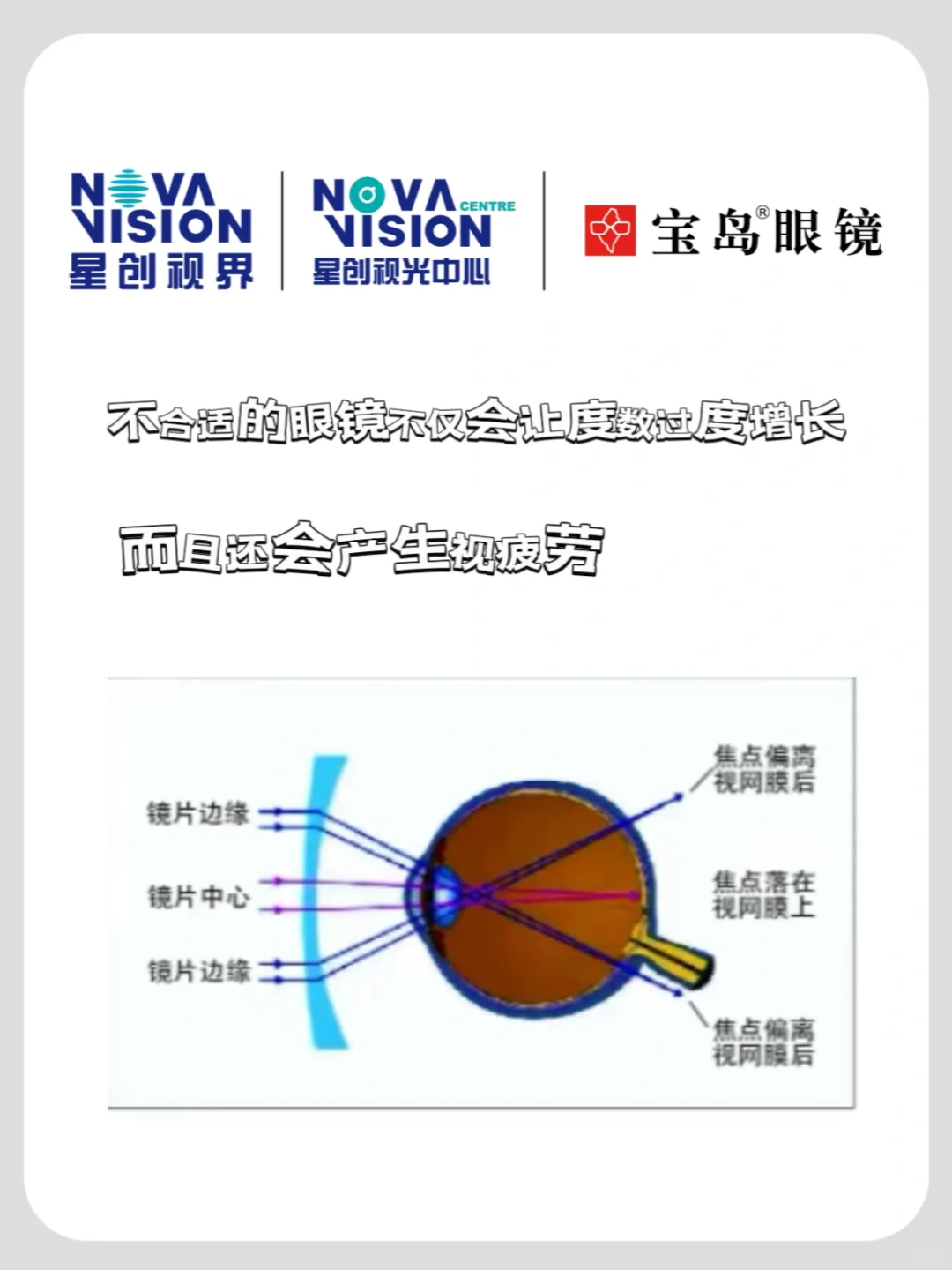 有人说度数不能配太足，否则会越戴越深