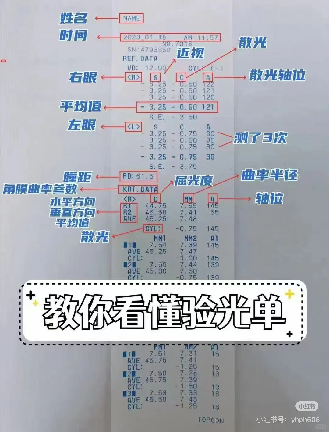 教你如何看懂验光单,配镜不被忽悠。