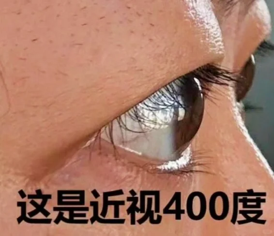 近视眼原来是这样