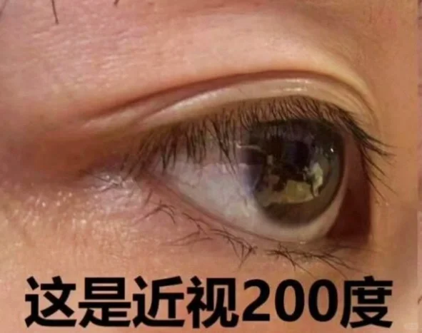 近视眼原来是这样