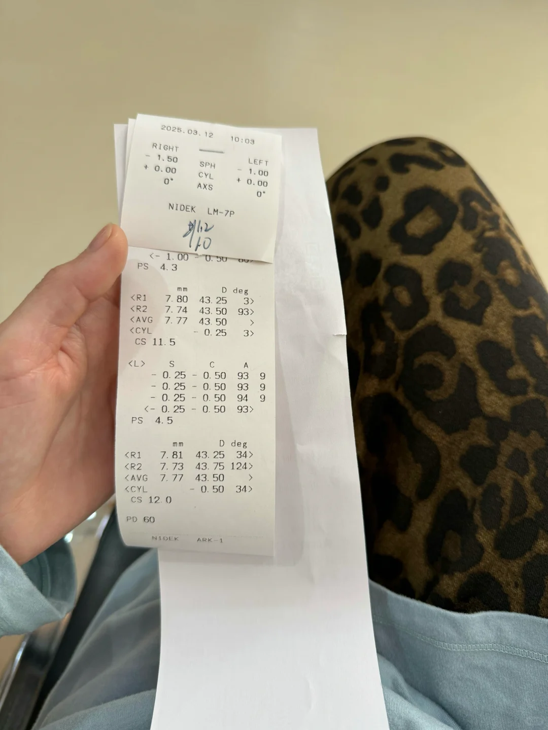 300多度近视直线下降到好了？后续度数确定！！