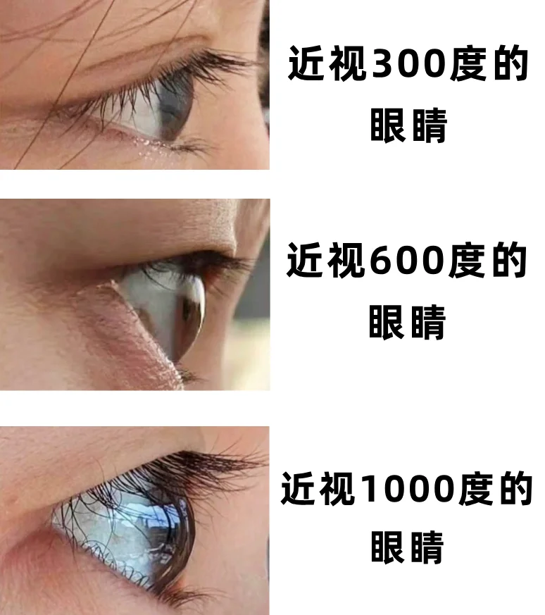 近视人的眼睛，差别也太大了！！