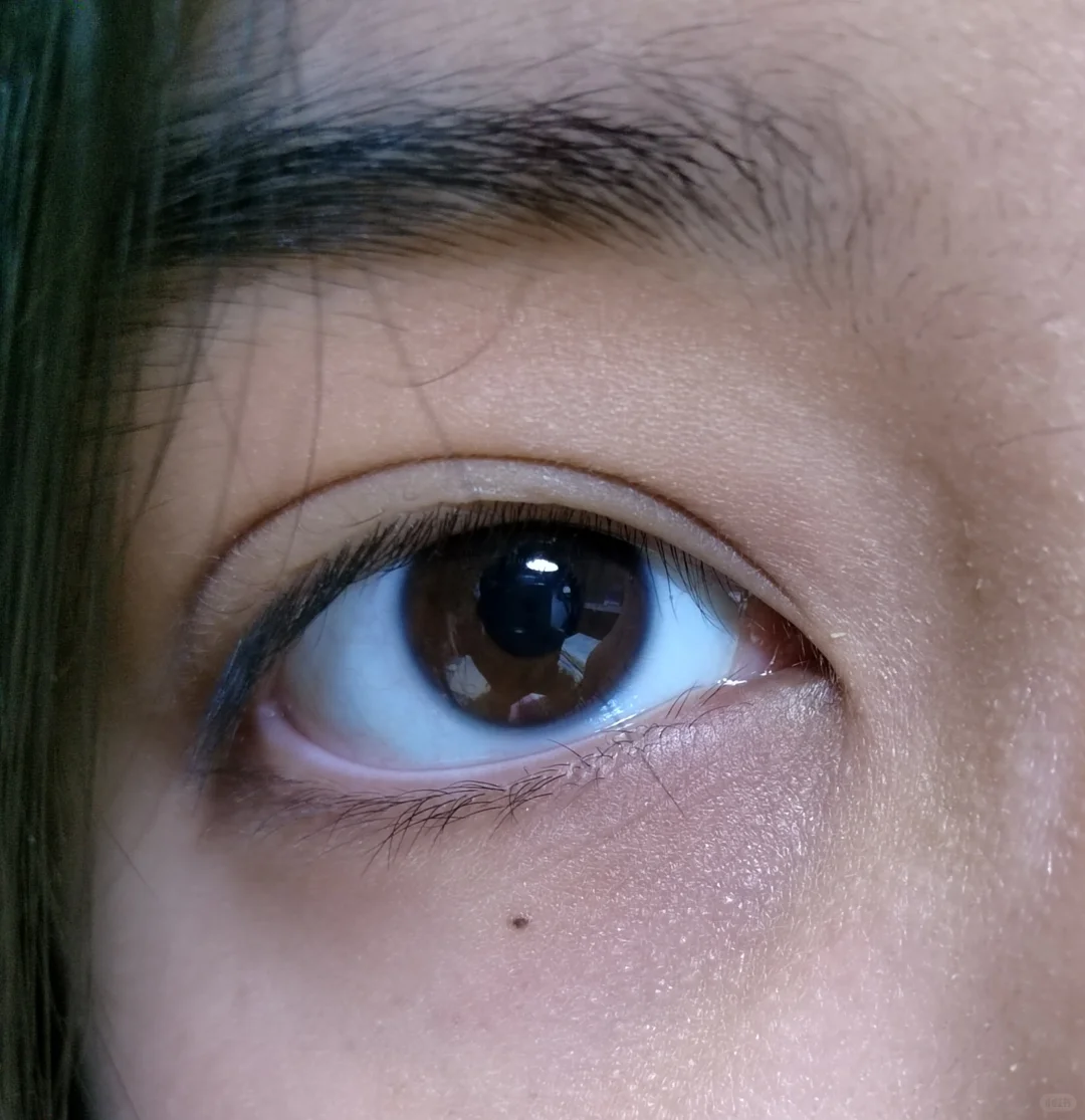 近视800度的眼睛长啥样