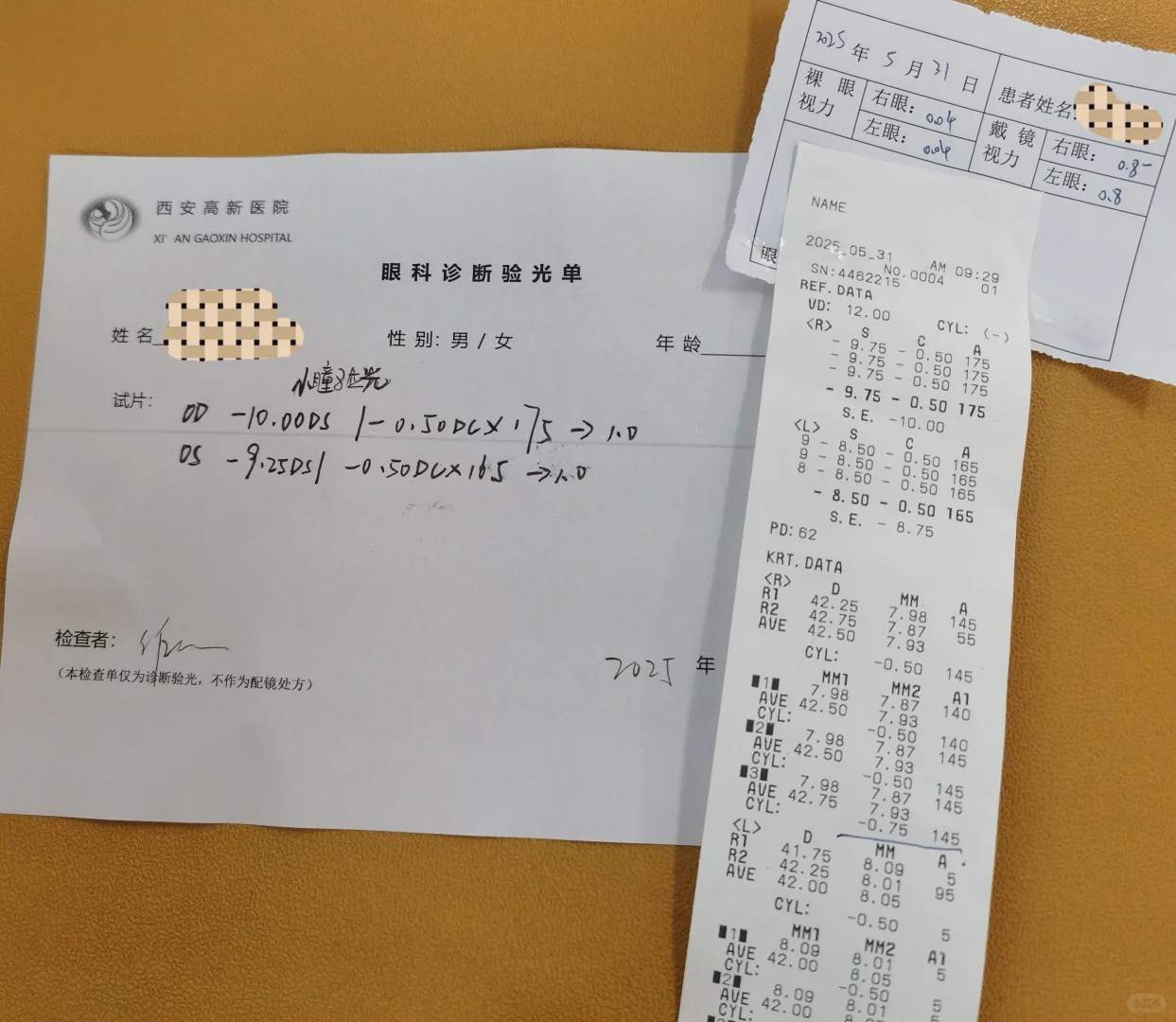 千度近视自救降度数