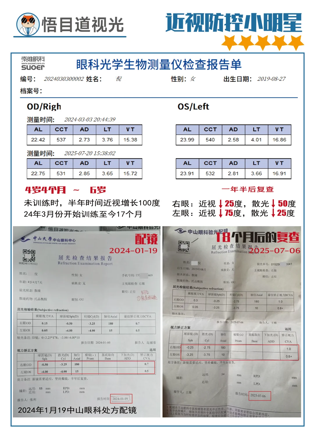 视功能训练到底有没有用？！