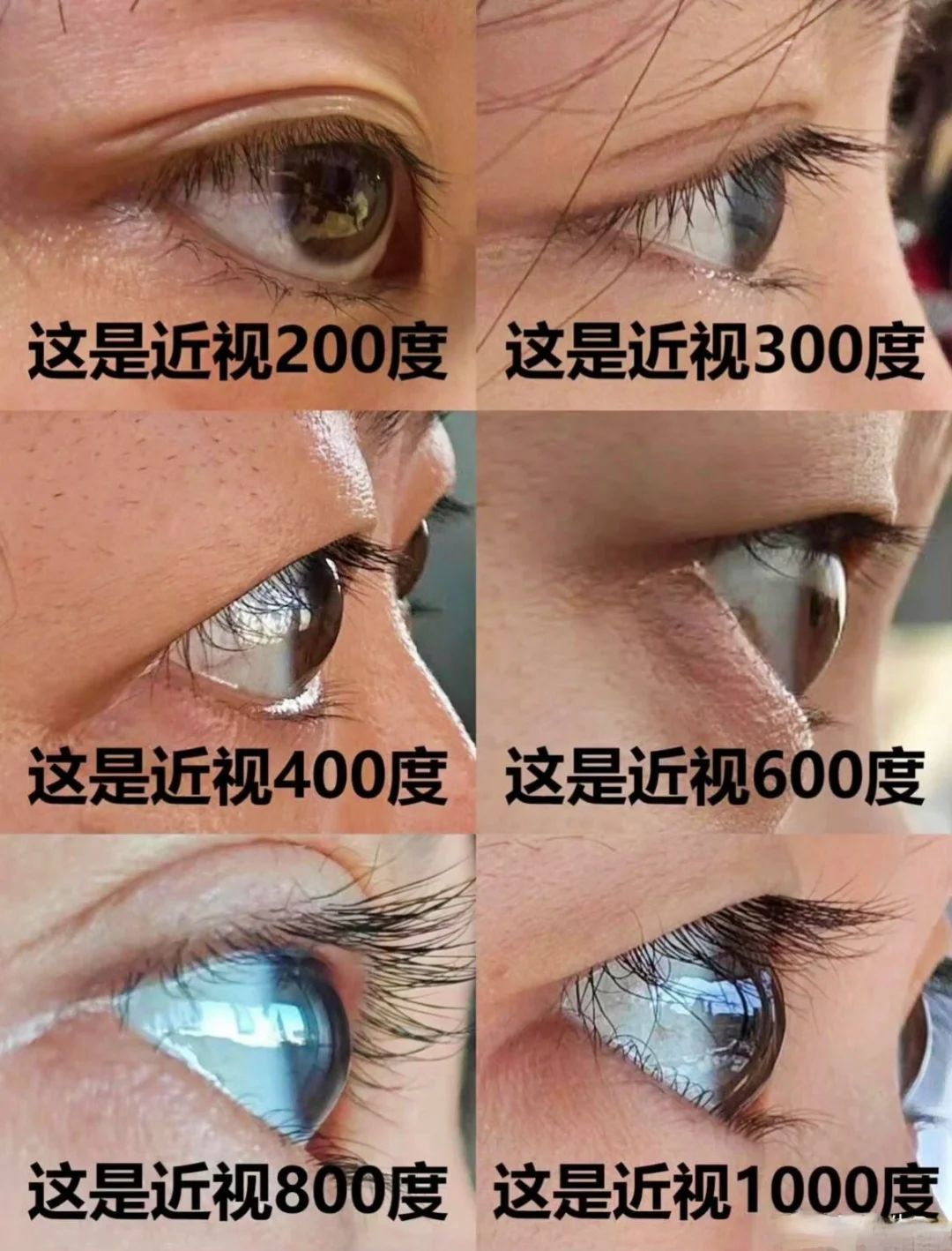 近视眼原来是这样