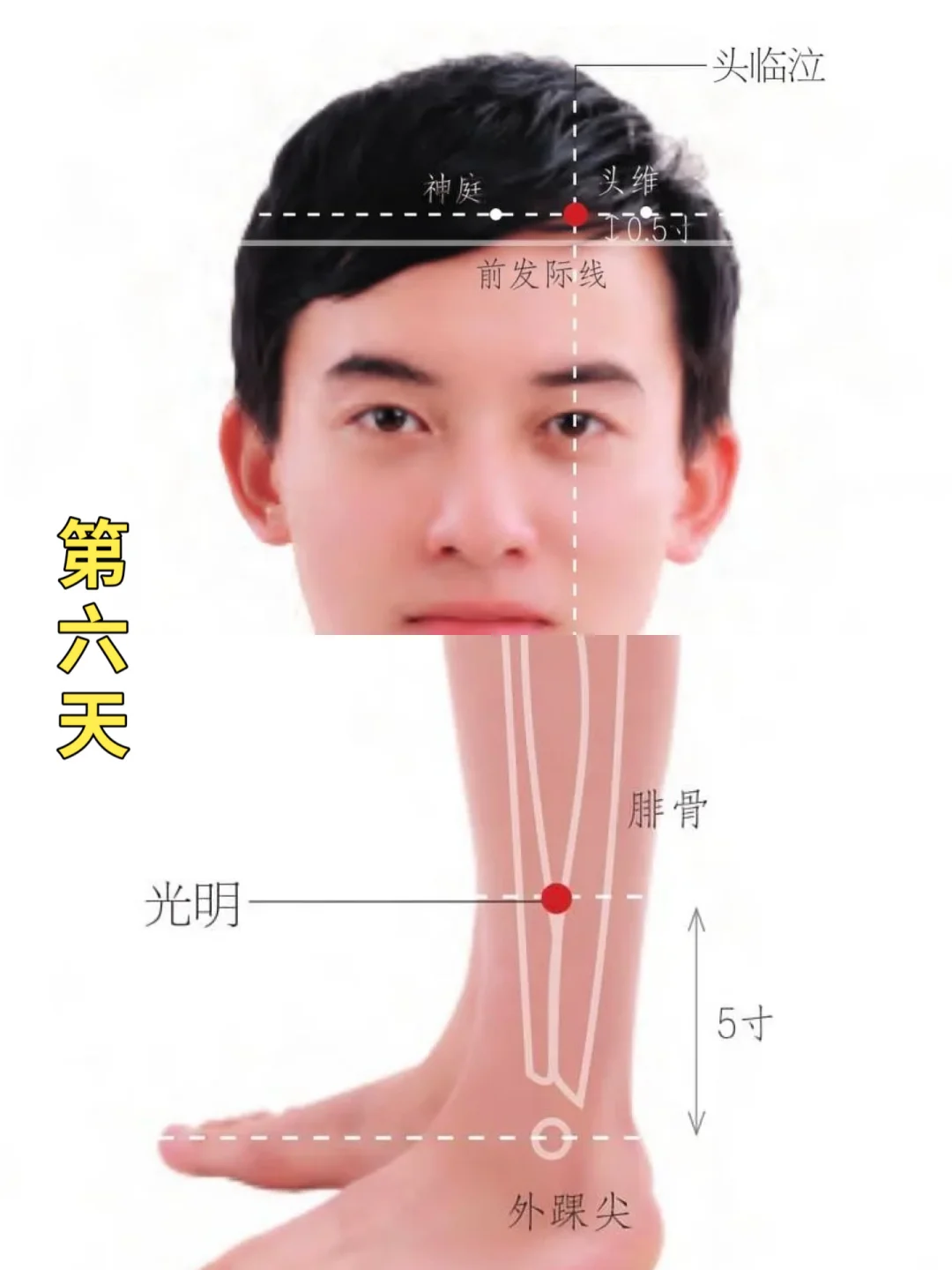 艾灸两个月近视散光！！