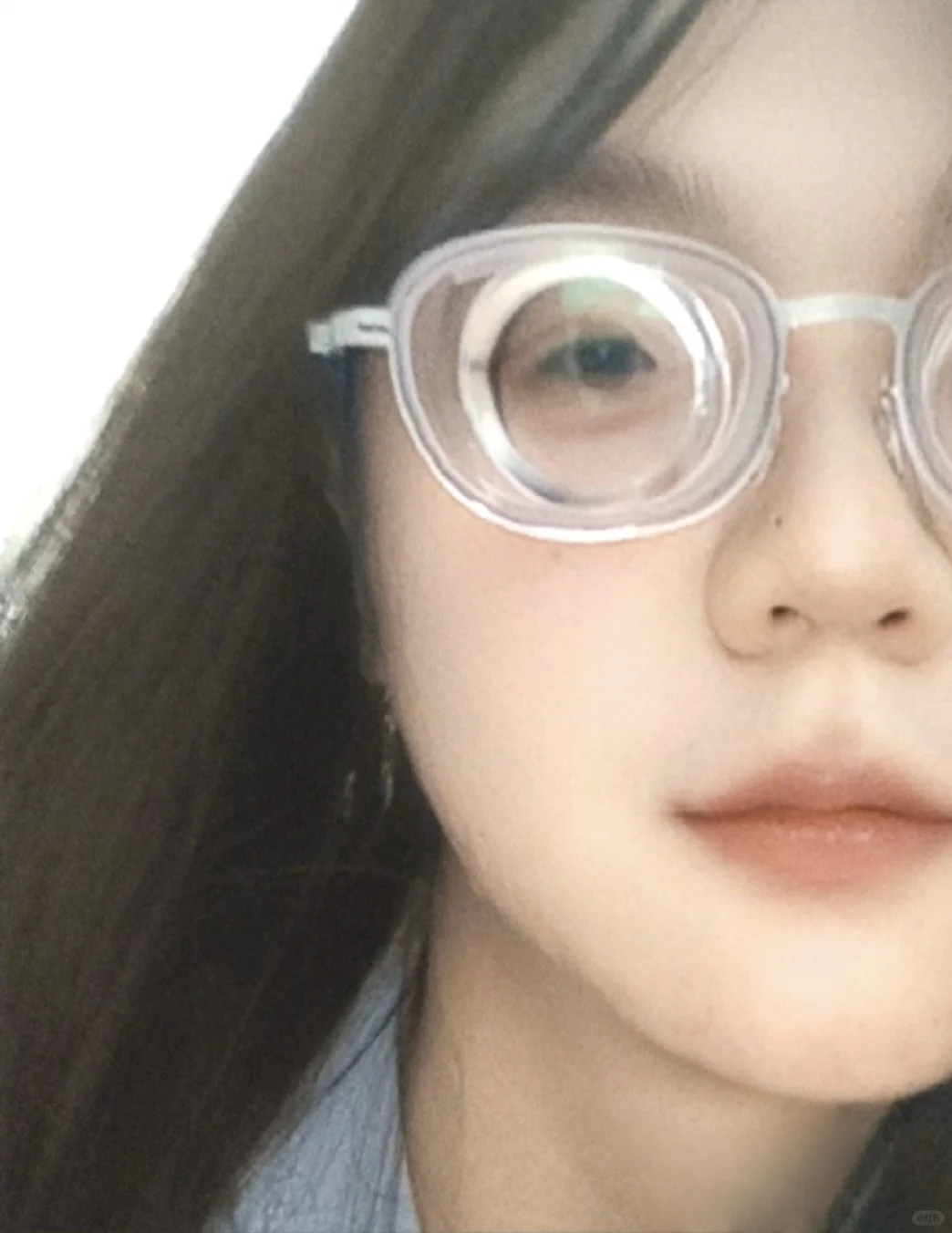 高度近视的痛苦