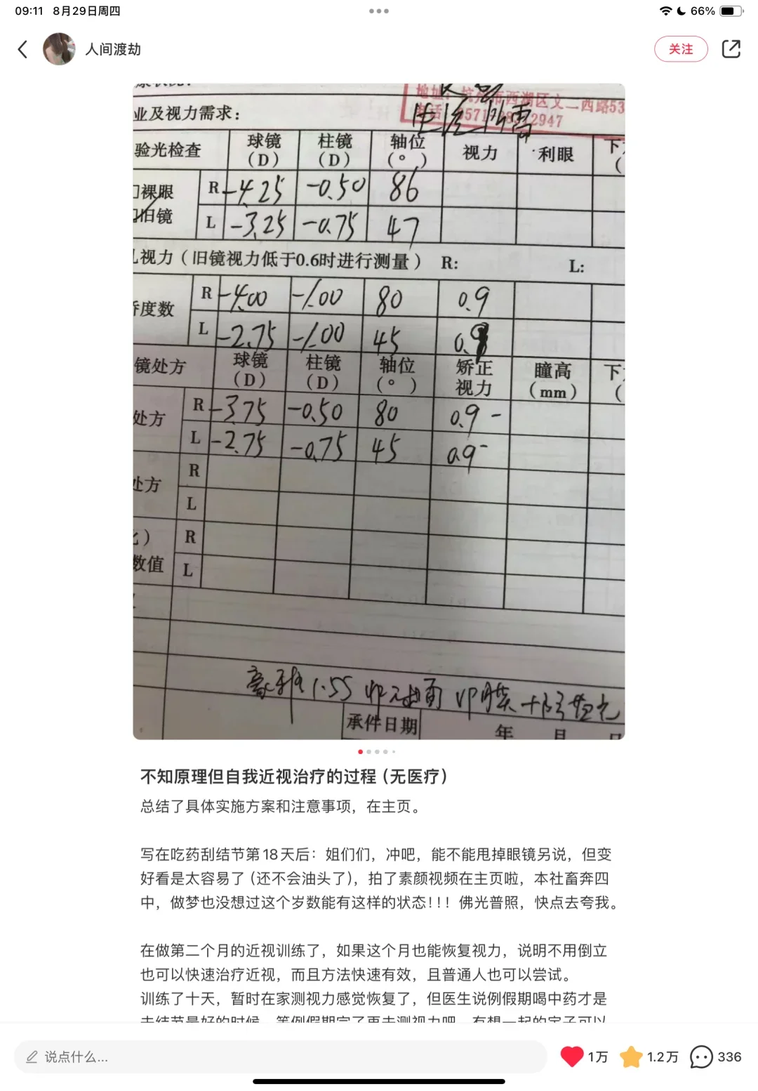 分享几个我信任的近视博主和视力恢复方法