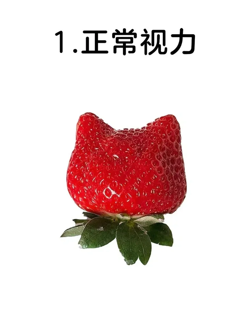 ?近视度数分级你知道吗?