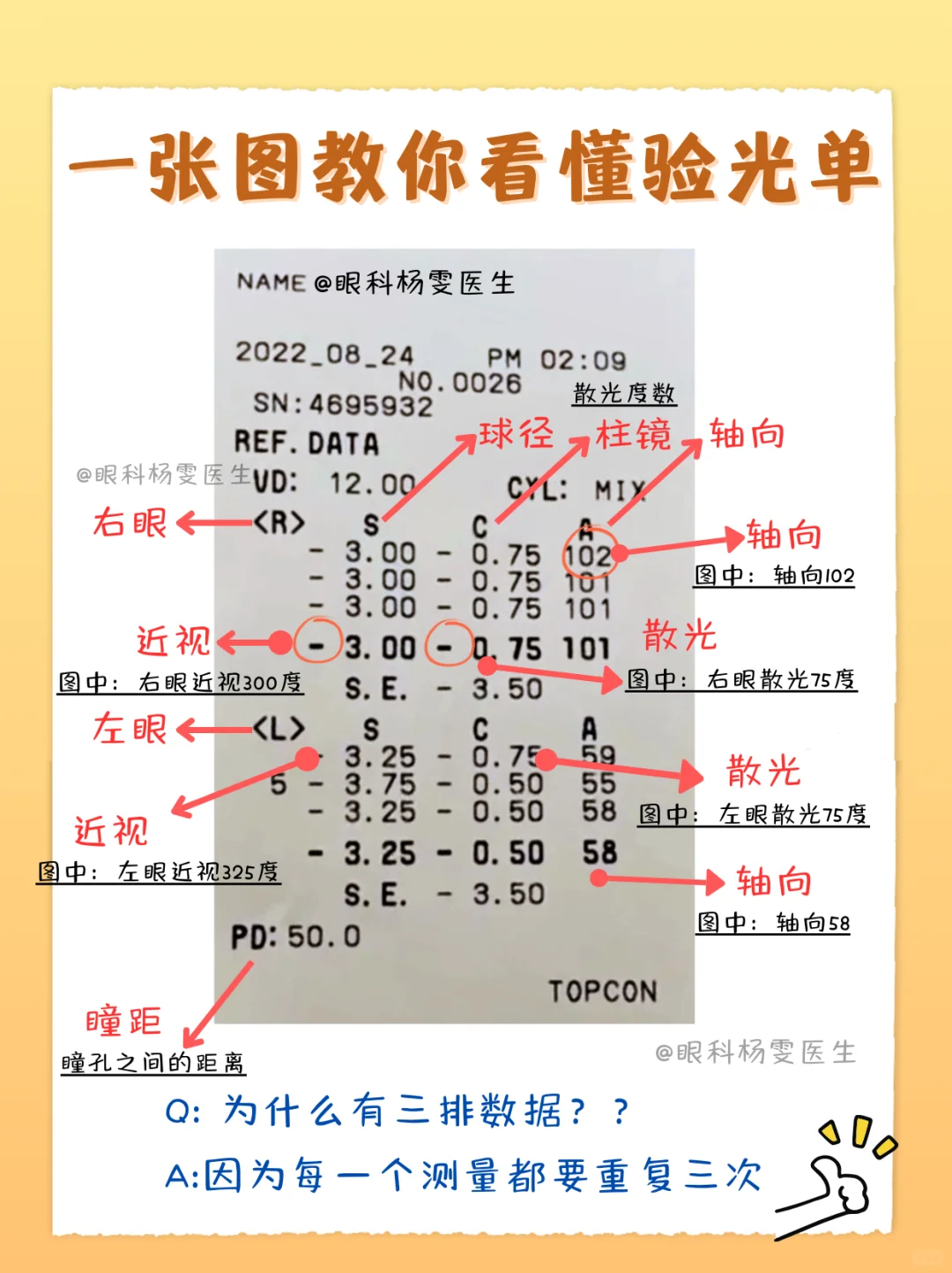 还不会看验光单?一分钟教会你!
