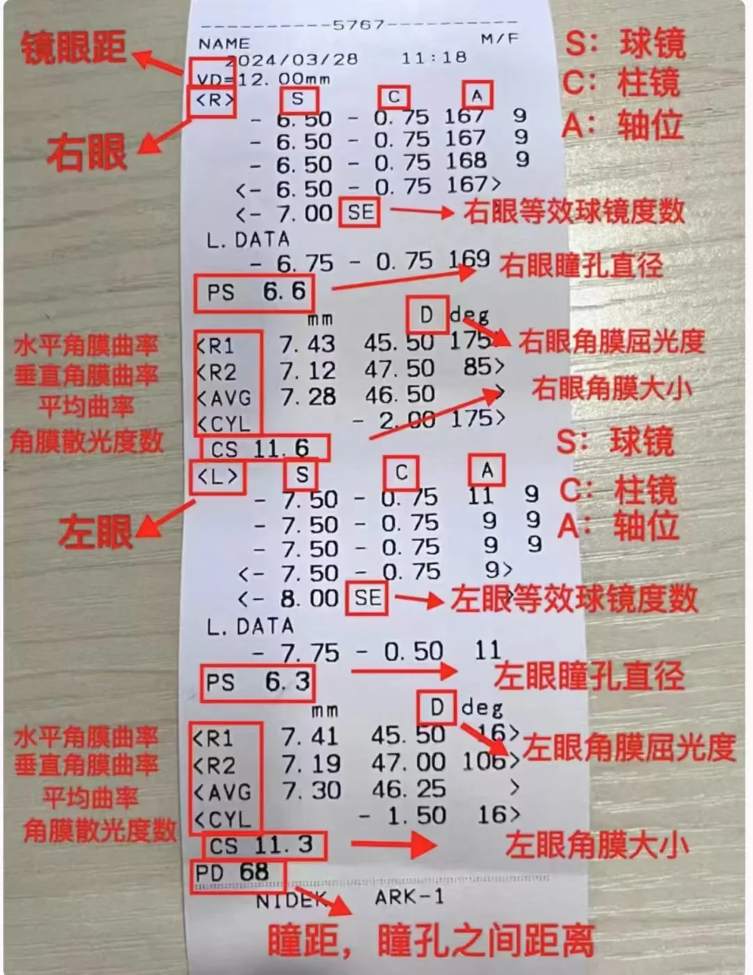 一张图看懂生物测量仪、电脑验光单！
