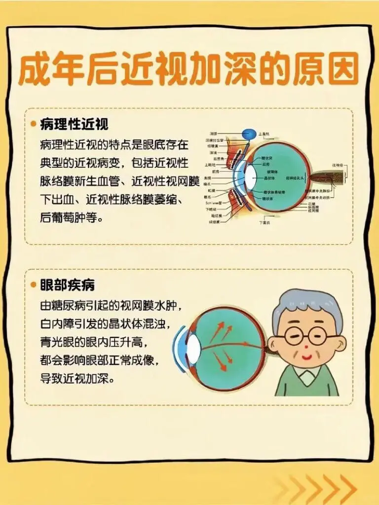 为什么近视度数会一直增涨?