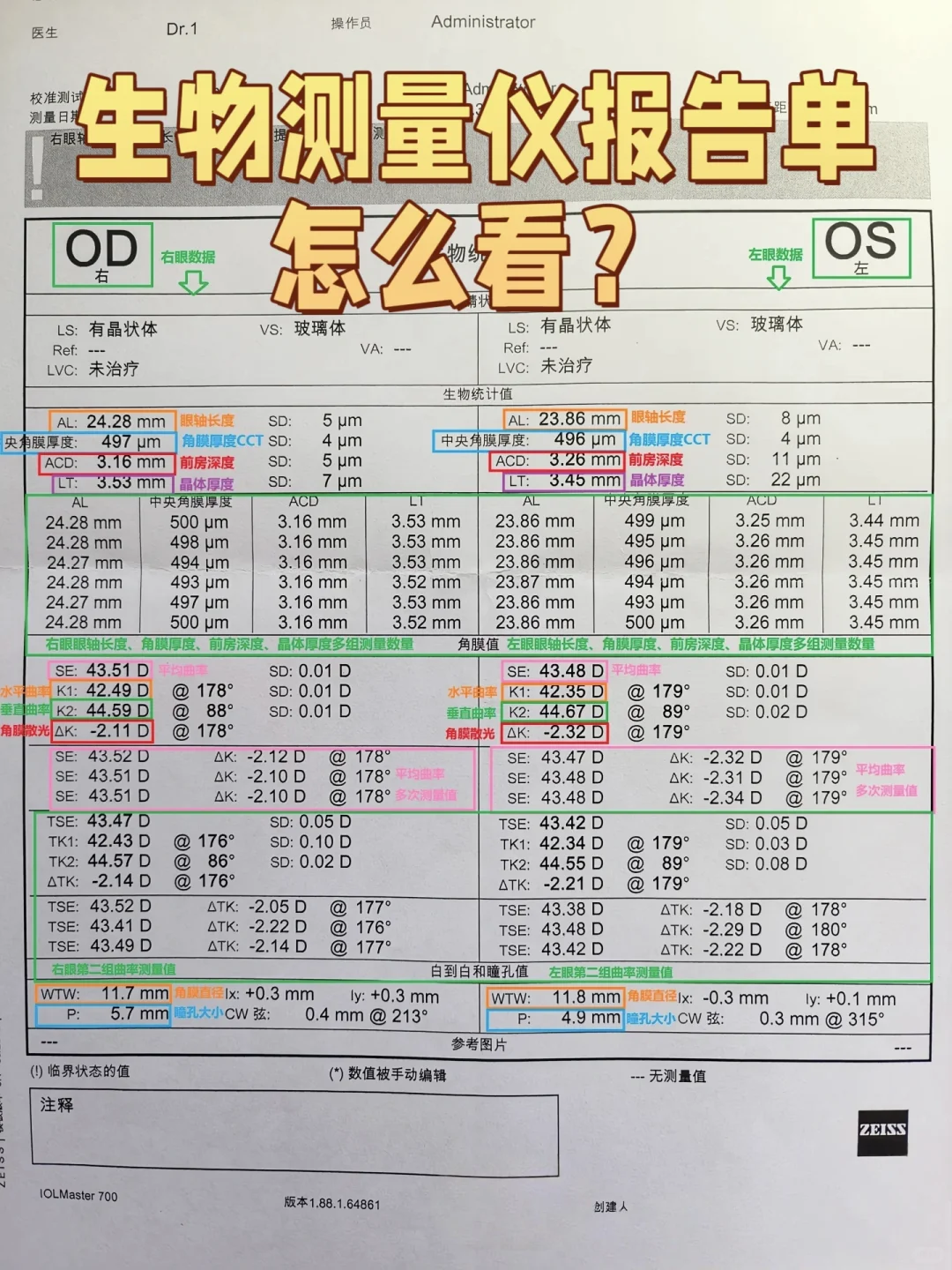 一张图看懂生物测量仪、电脑验光单！