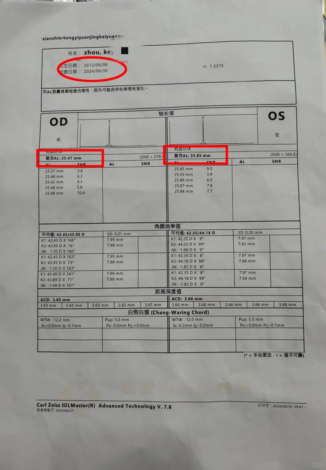 你会给孩子测量眼轴吗，西安来这家就对了