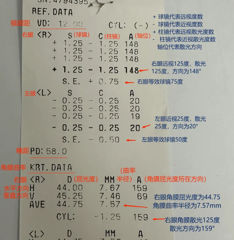 看懂近视验光表