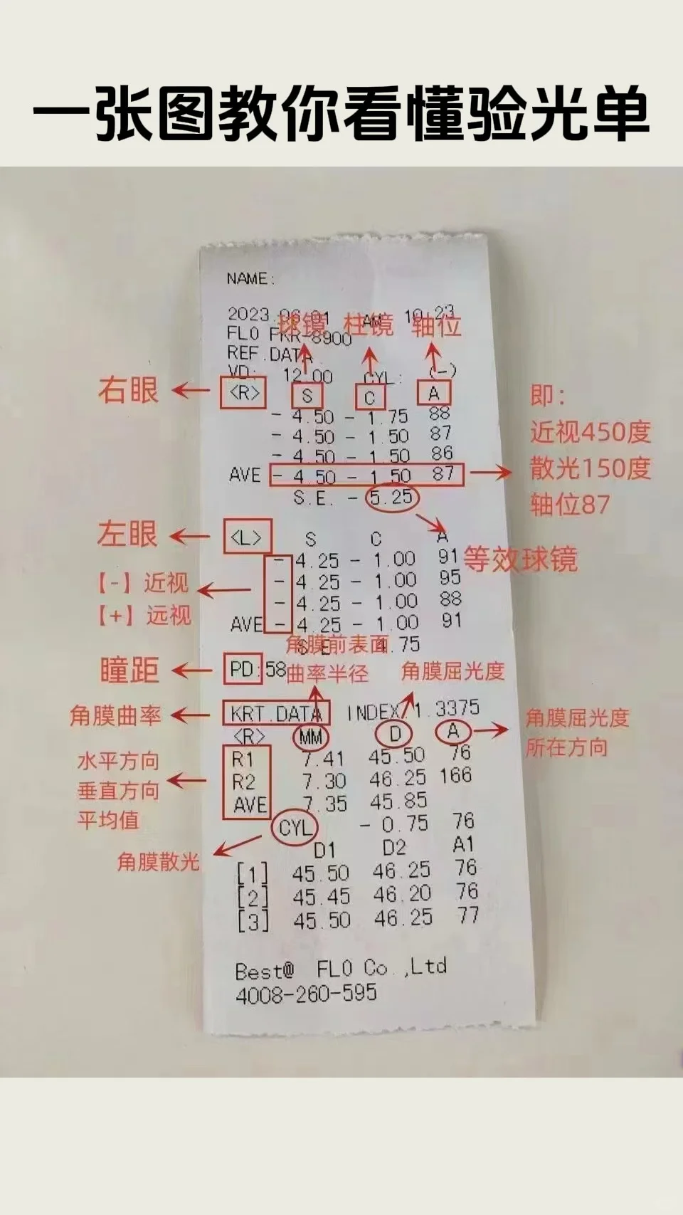还不会看验光单❓?手把手教你学会看验光单