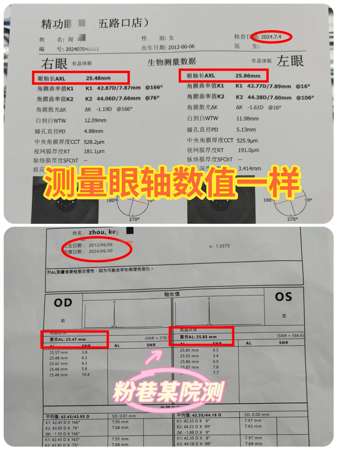 你会给孩子测量眼轴吗，西安来这家就对了