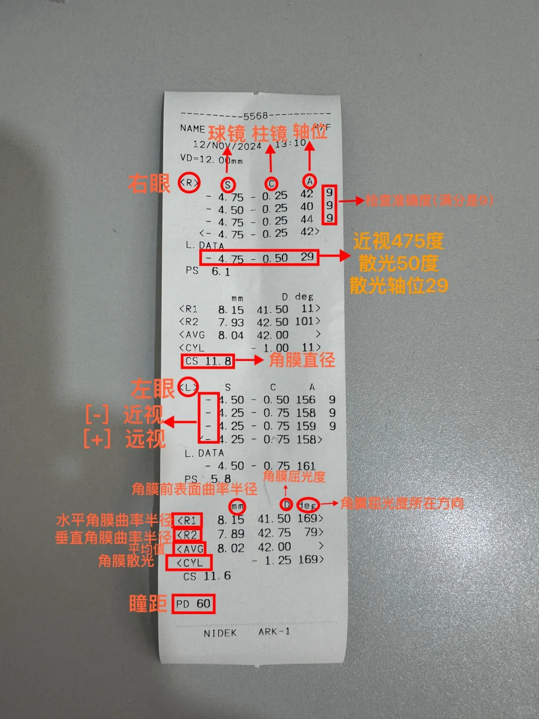 还不会看电脑验光单吗？一分钟教会你