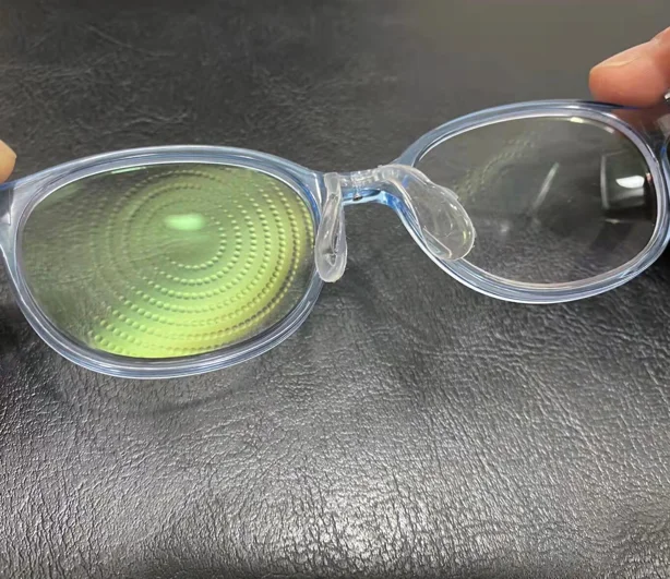 半年度数涨了100度，离焦镜拯救焦虑！