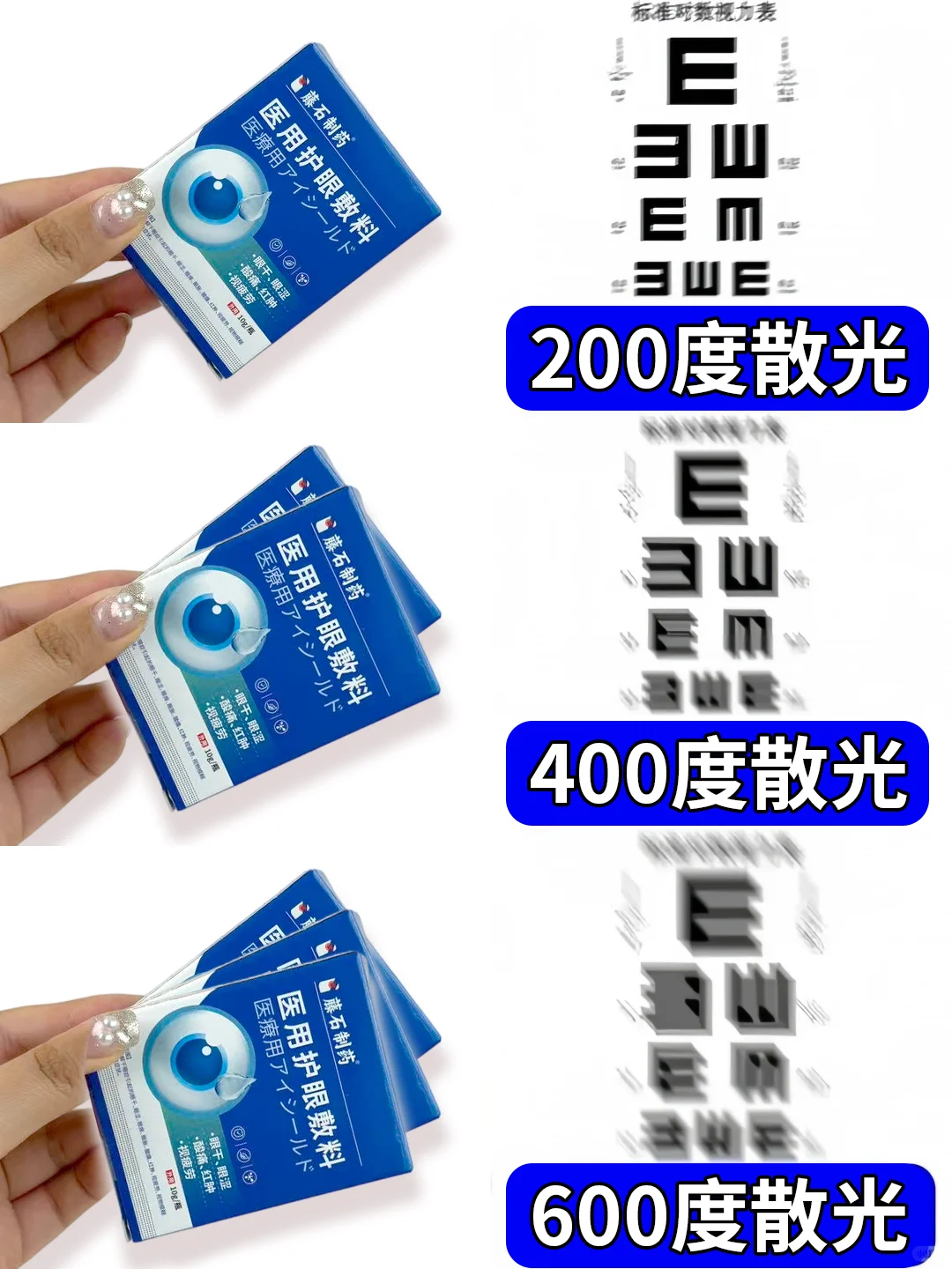 散光别再拖！度数涨涨涨