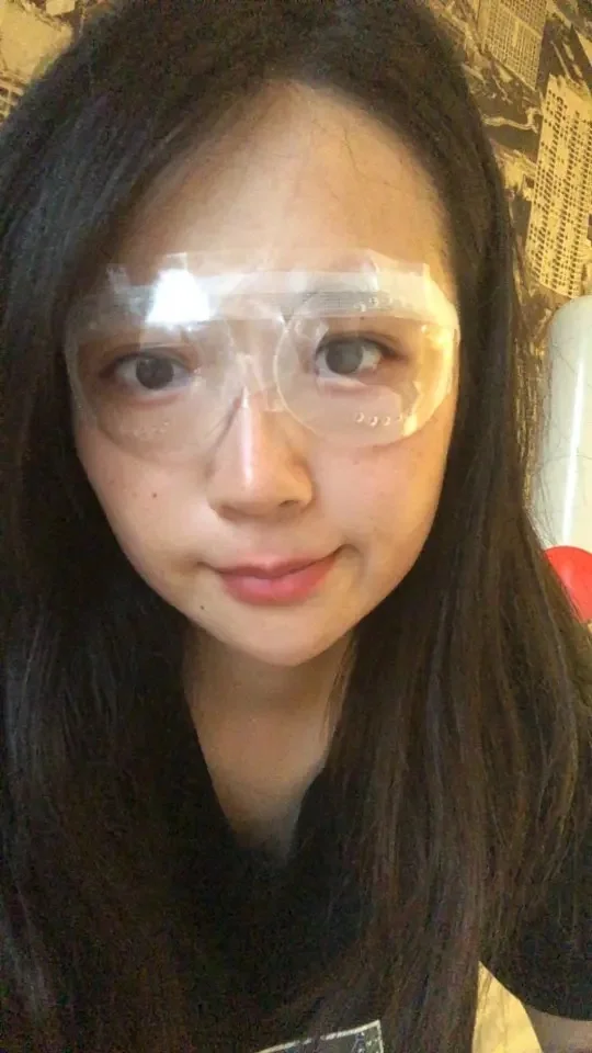 900+度高度近视半飞秒恢复第一周 随便问