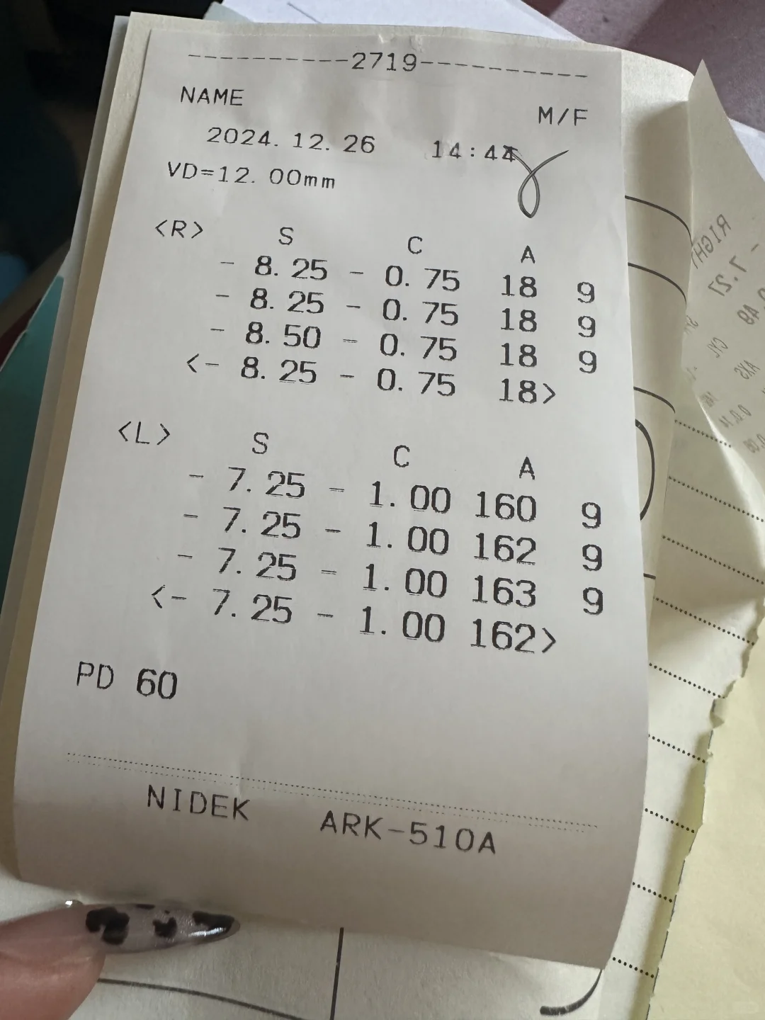 配眼镜到底是配正好的还是低一点啊