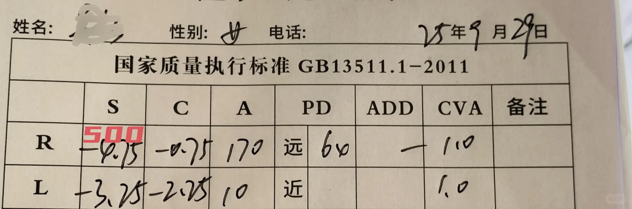 两周右眼近视降了25度 散光降了50度