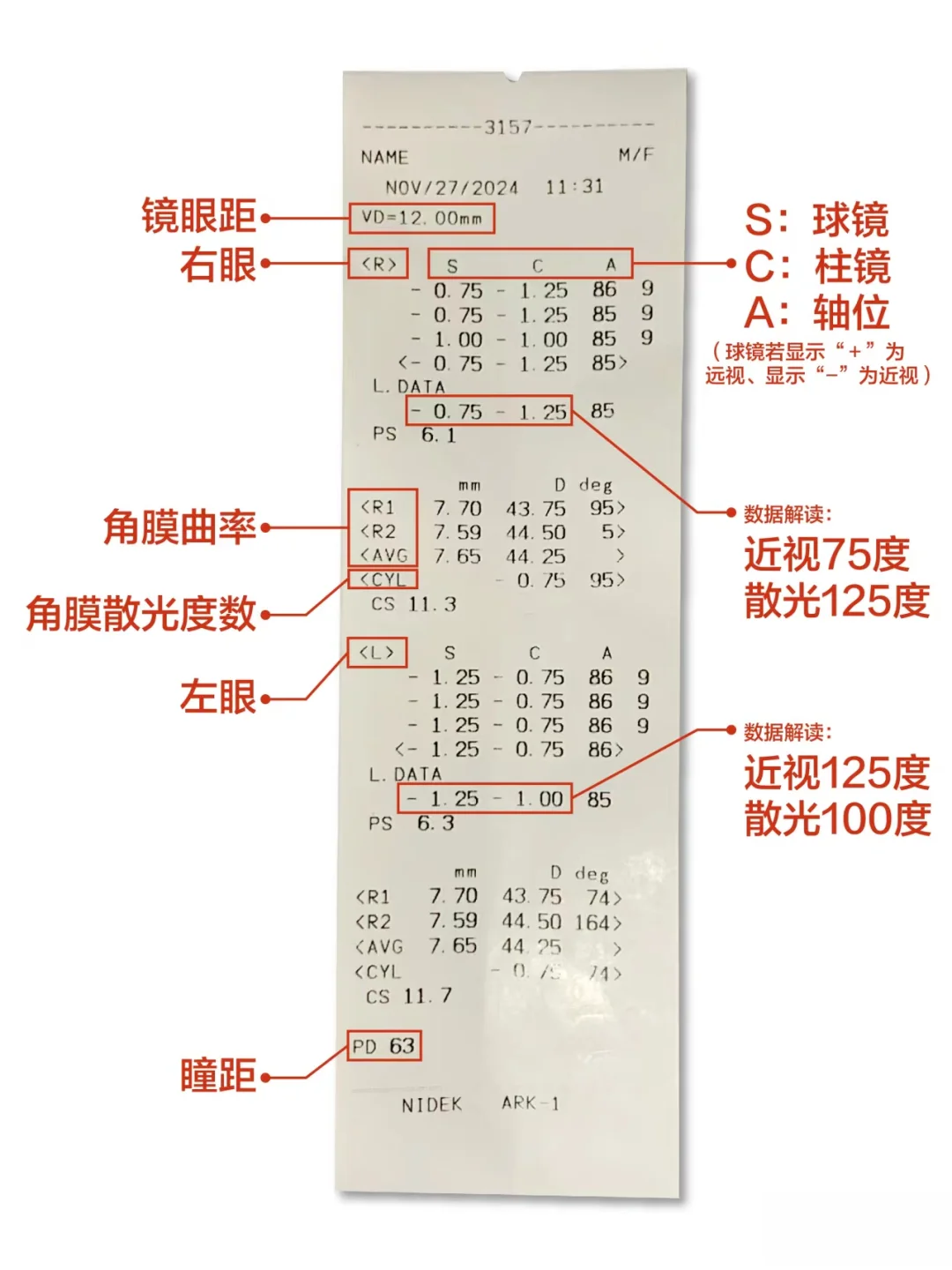 拿到验光单子，教你30秒看懂近视和散光度数