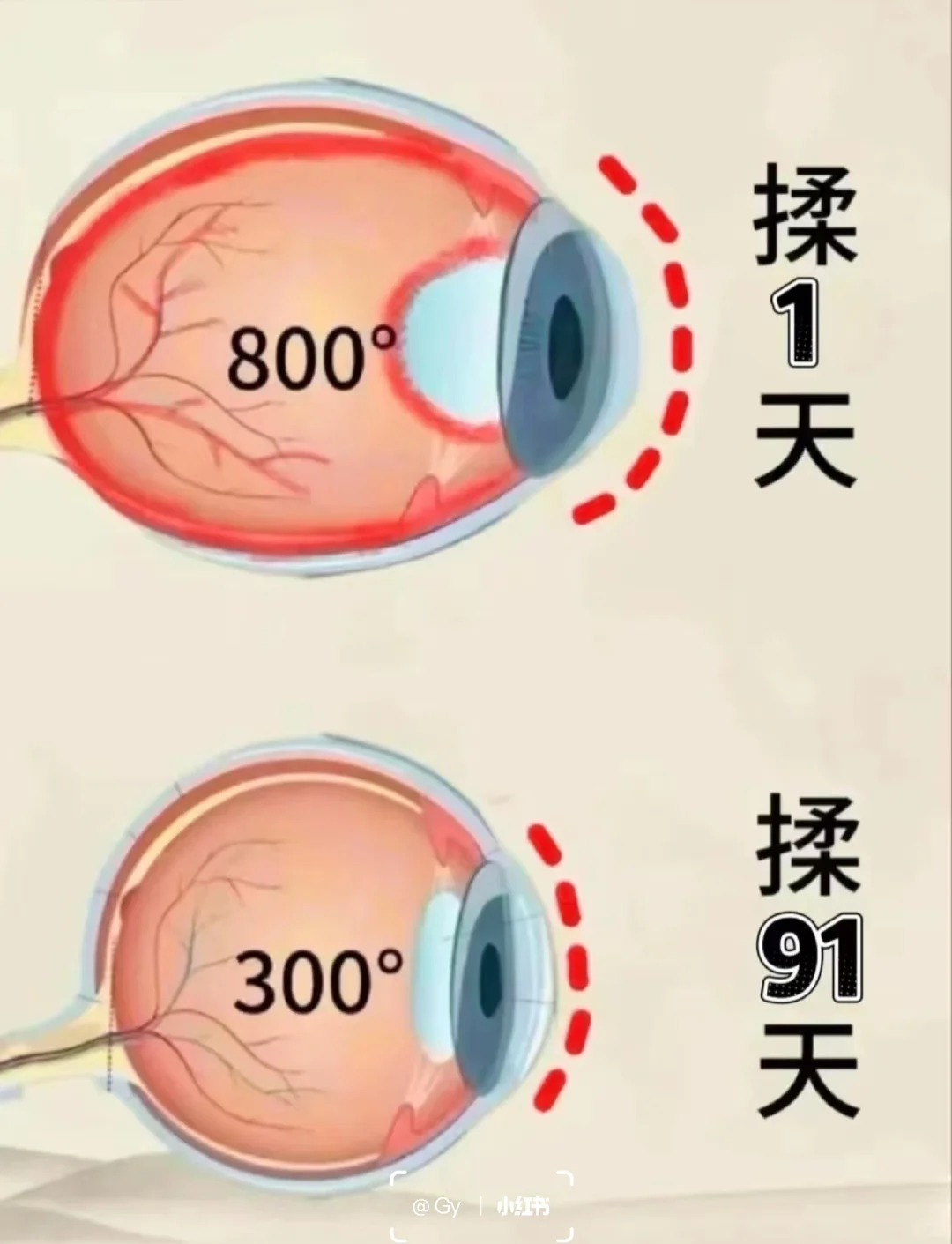 揉 开 这几处，结果很满意……