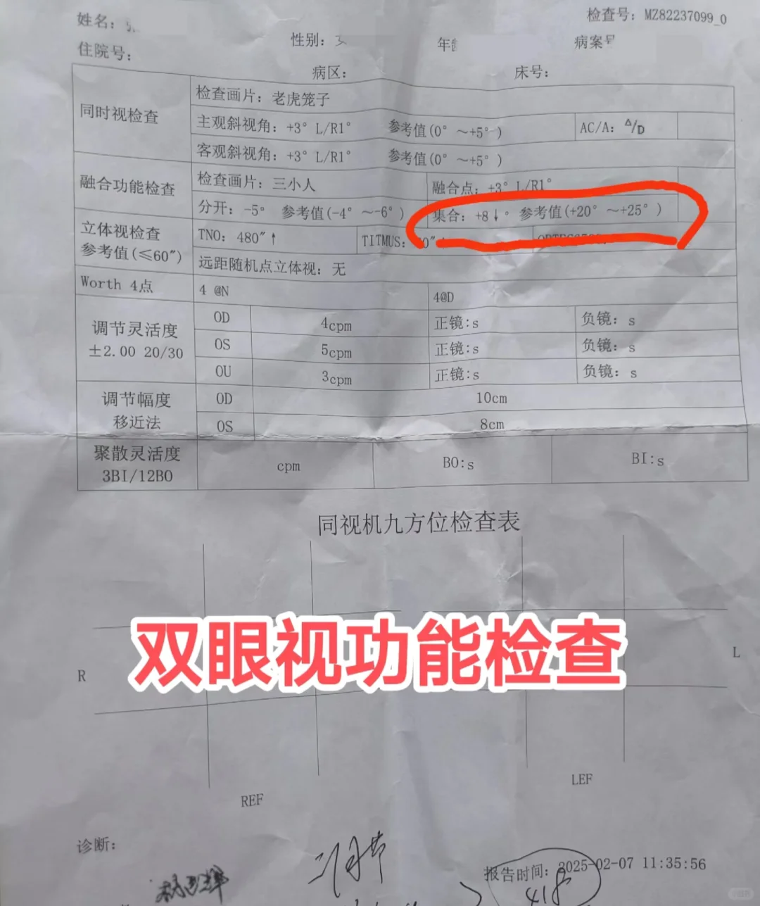 成年后近视度数不断加深的原因找到了4️⃣