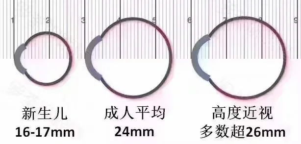 学会自己能估算近视度数